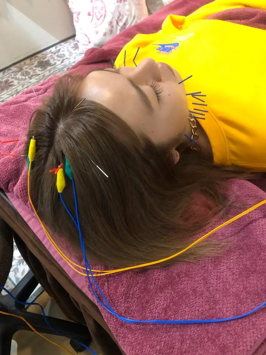 エステ リラク 美容鍼灸女性専用 りんご鍼灸治療院のその他イメージ