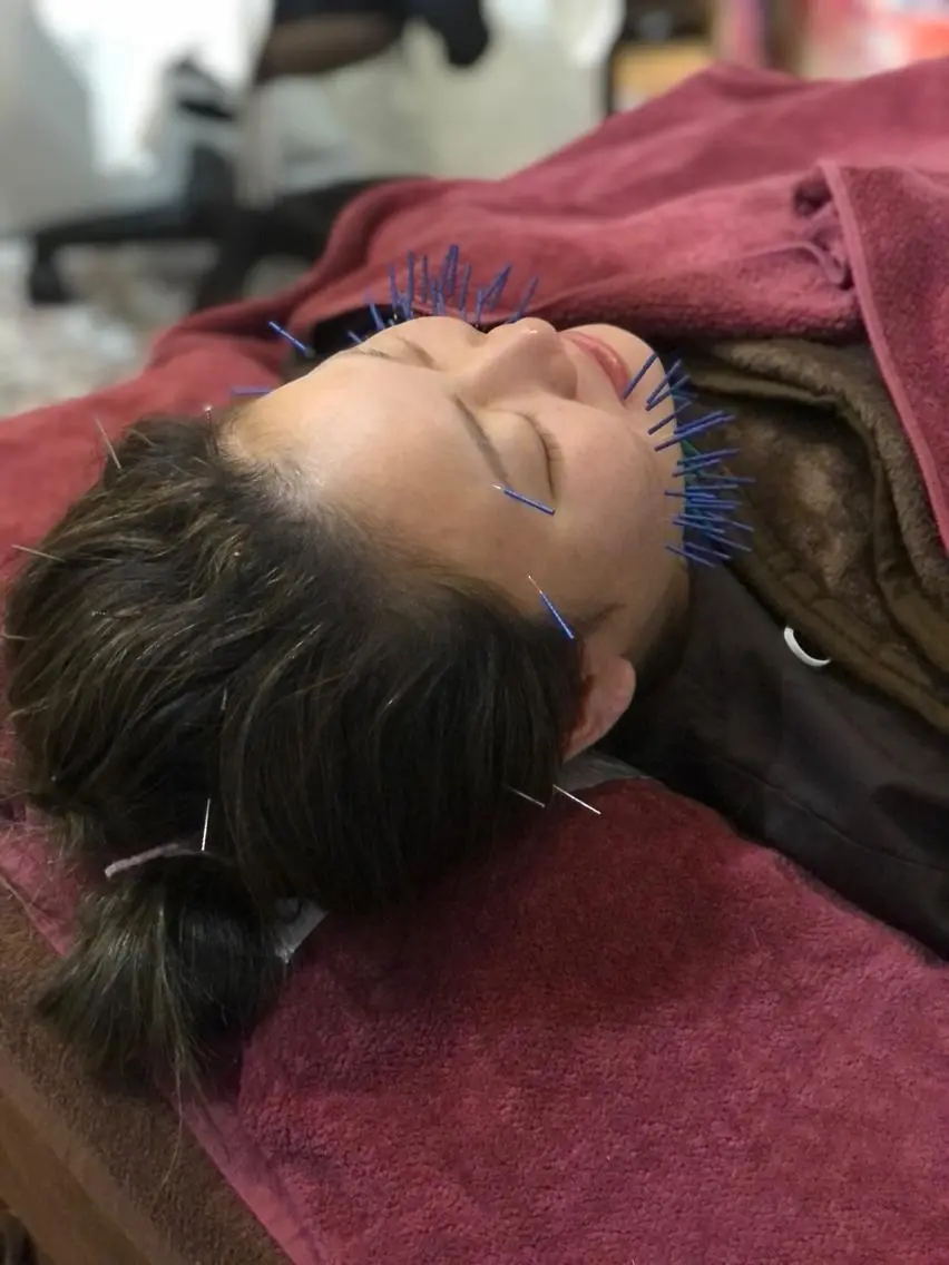 エステ リラク 美容鍼灸女性専用 りんご鍼灸治療院のその他イメージ