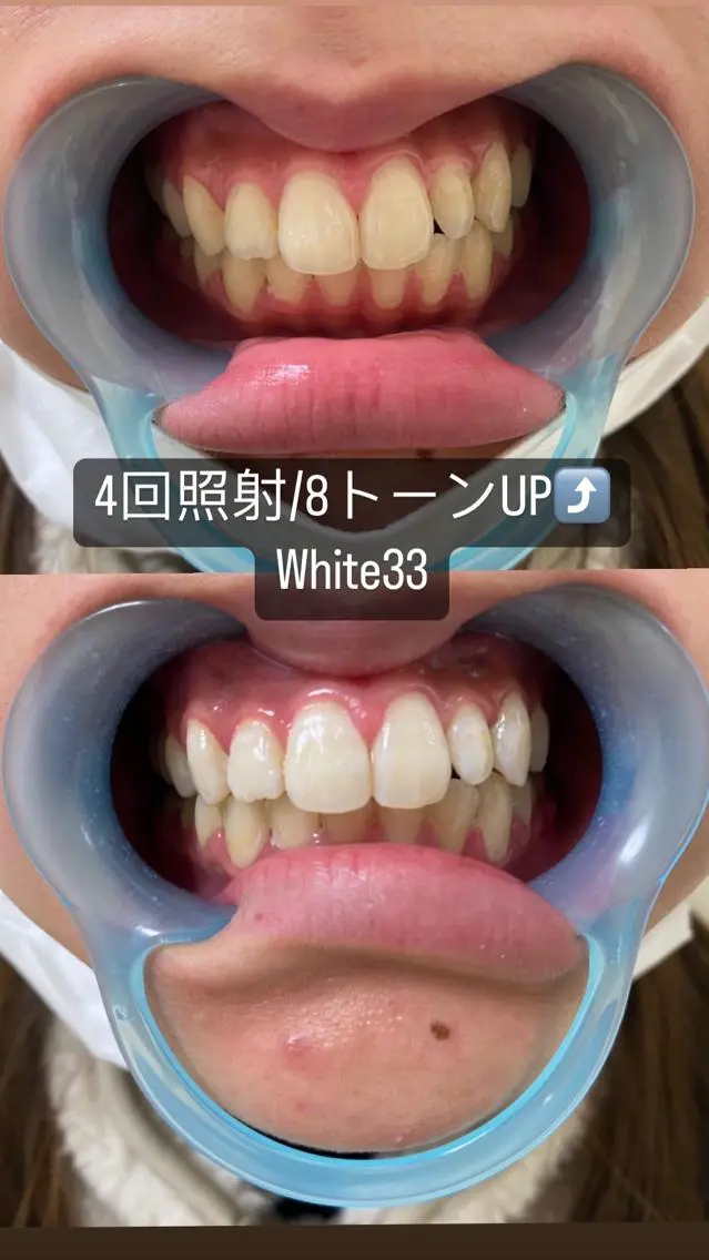 アイブロウ セルフホワイトニング White33大名のその他イメージ