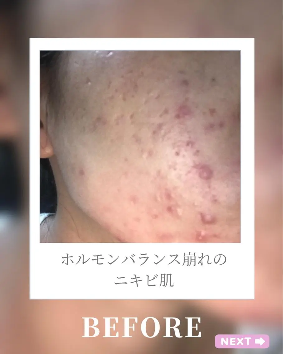🎀BiBi韓国美容 コスパ強！美活サロンのエステ・リラクイメージ