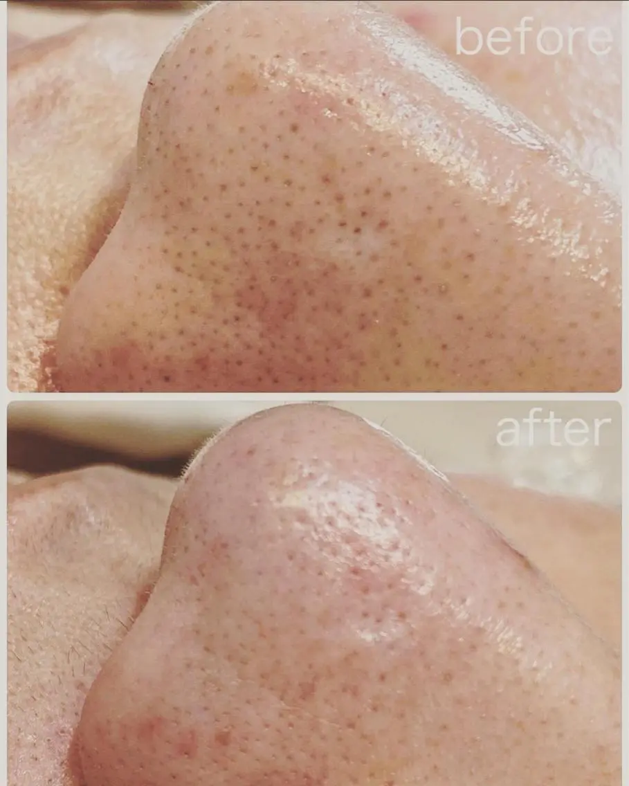 Lilld eyelash大井町のマツエク・マツパデザイン