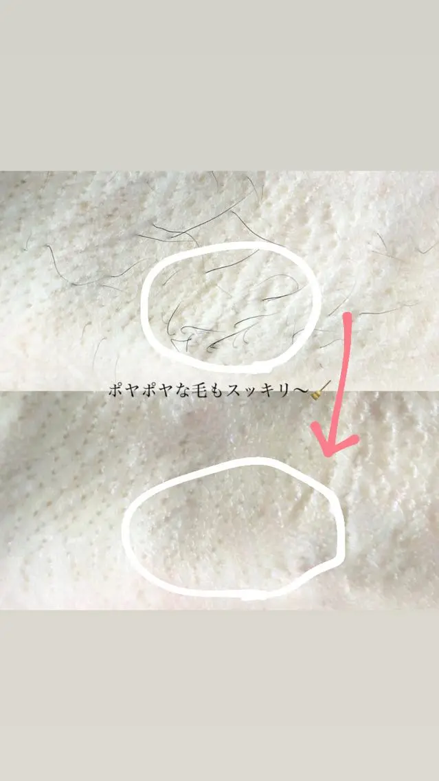 脱毛 &me ayakaのエステ・リラクイメージ