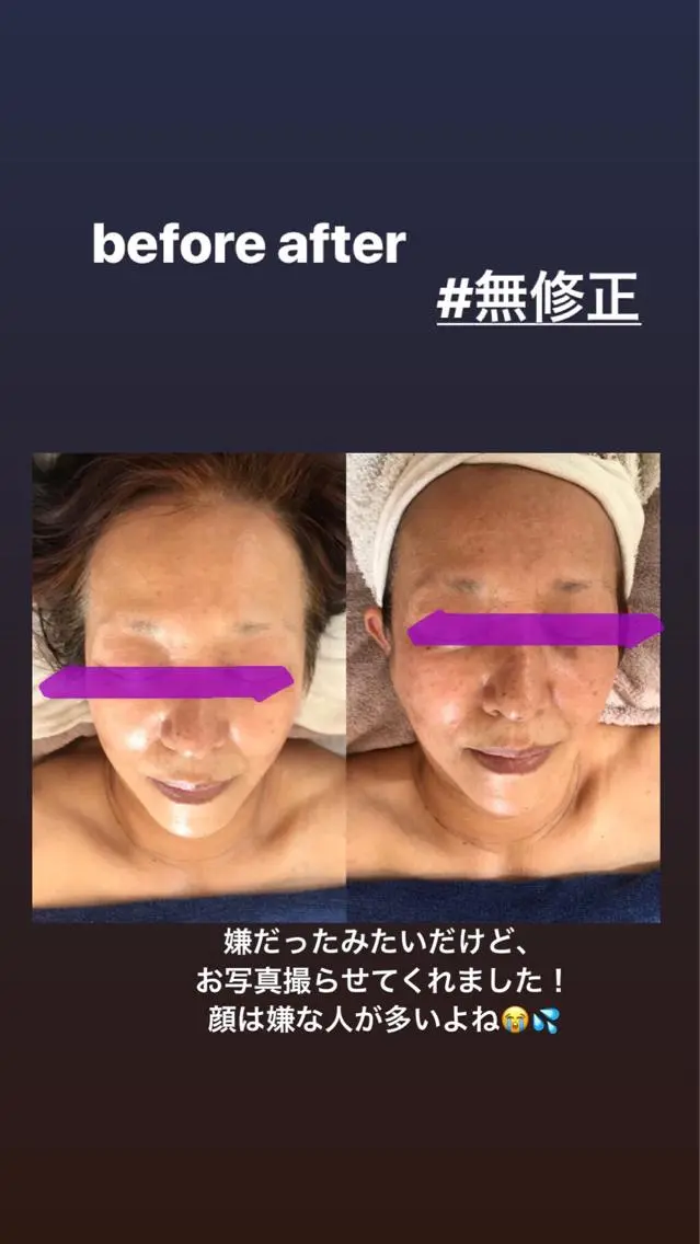 エステ リラク ☺︎ CH I Iのマツエク・マツパデザイン