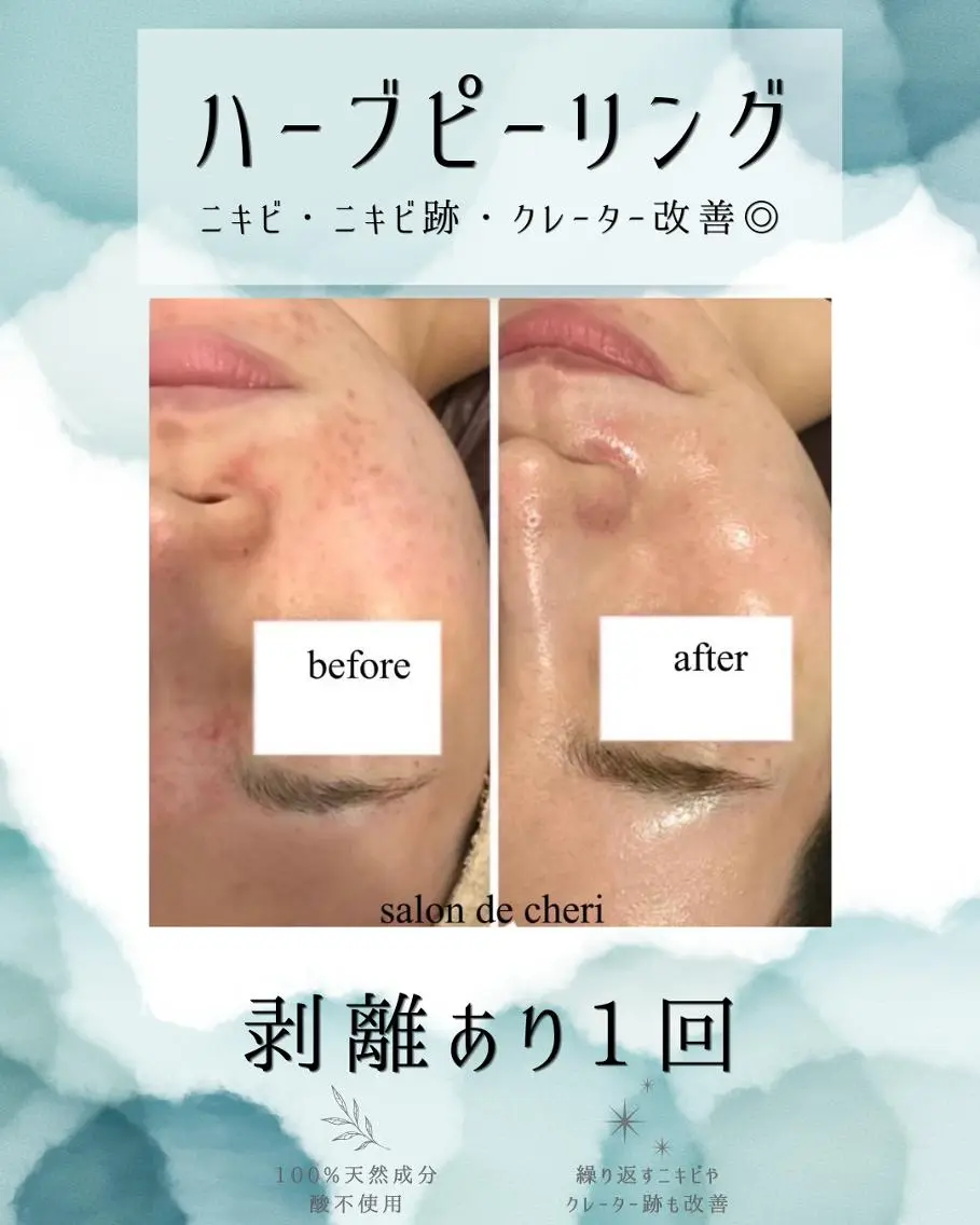 エステ リラク 医療提携 肌管理痩身エステ池袋のエステ・リラクイメージ