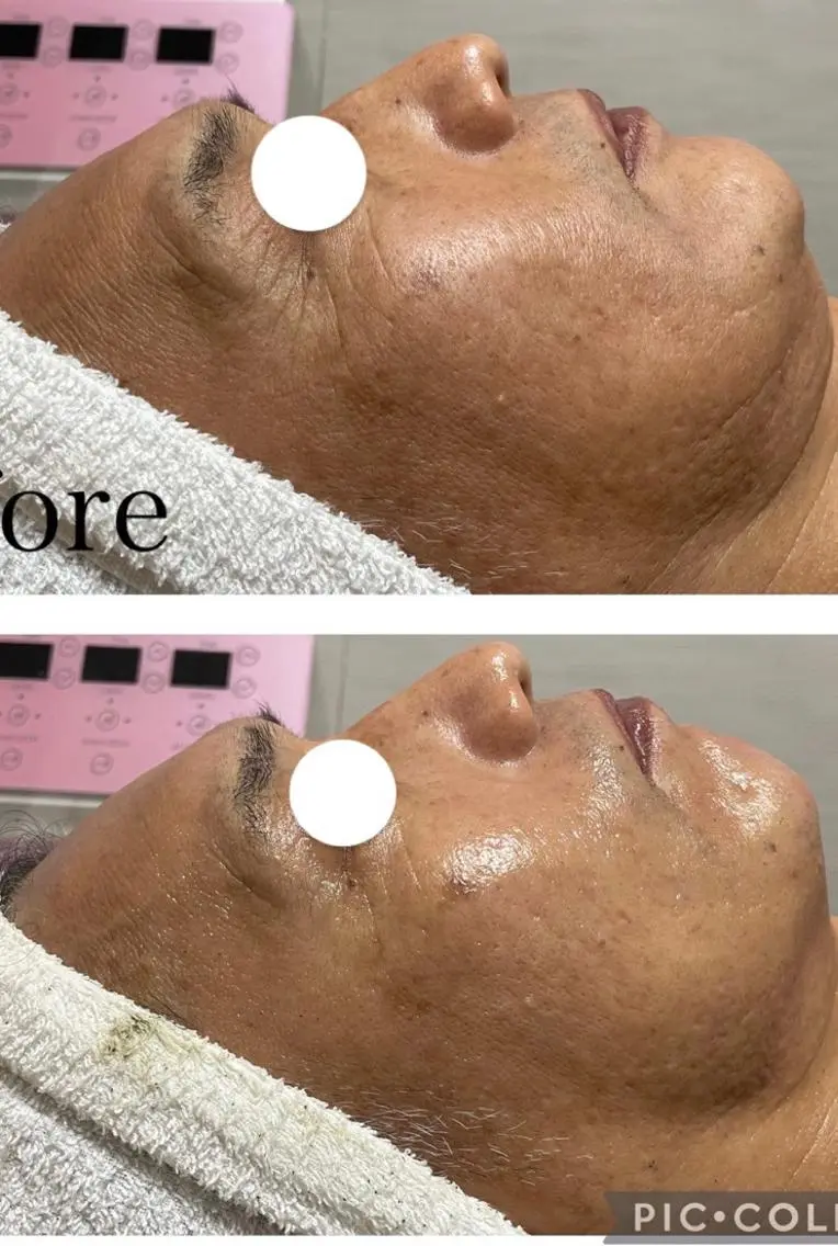 ビューティーサロン B.glossyのネイルデザイン
