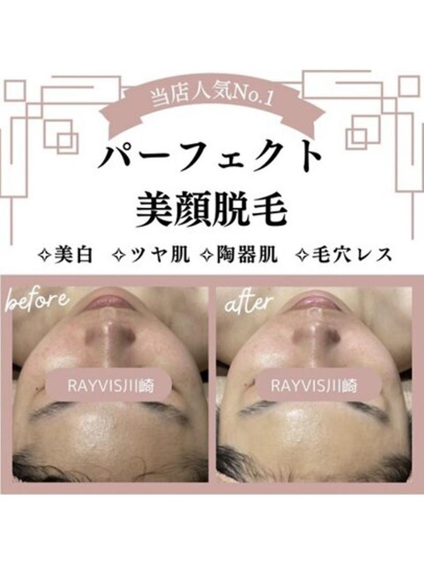 RAYVIS札幌店 💕SAKU💕のエステ・リラクイメージ