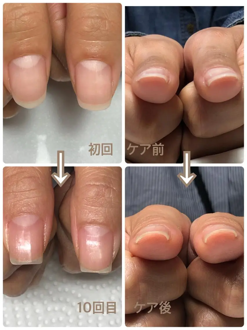 ネイル その他(ネイル) 自爪育成ネイルサロン Pause(ポーズ)のネイルデザイン