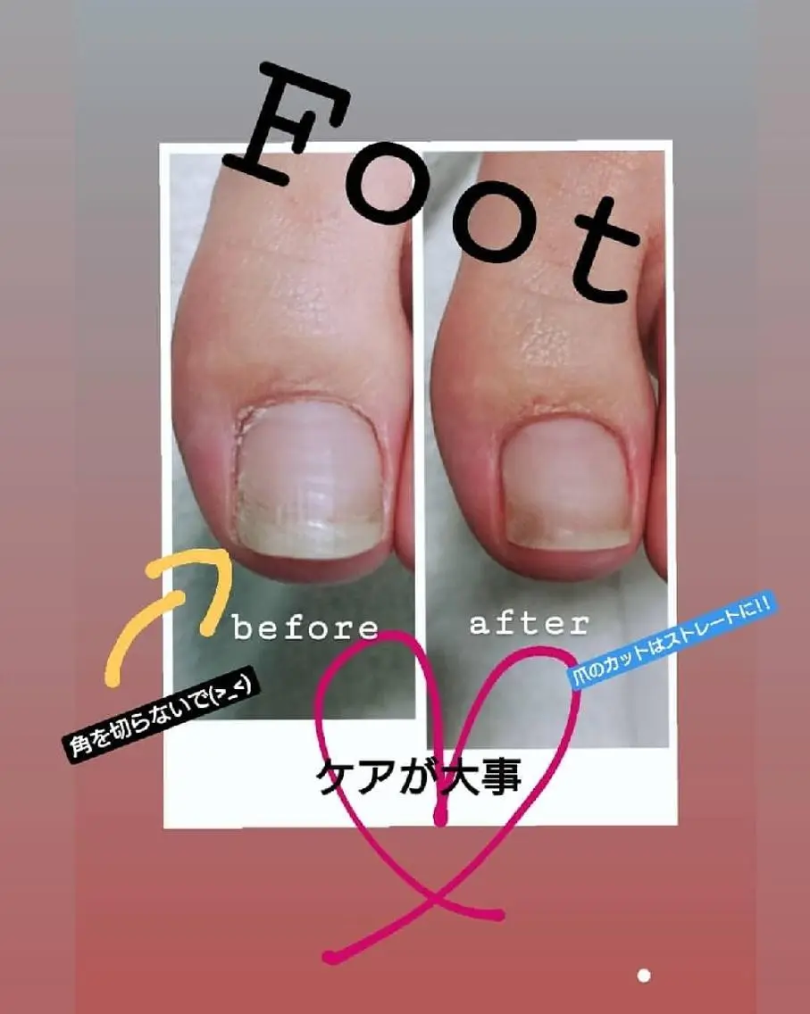 ネイル フットネイル フットネイル 市川駅 ✿中津のネイルデザイン