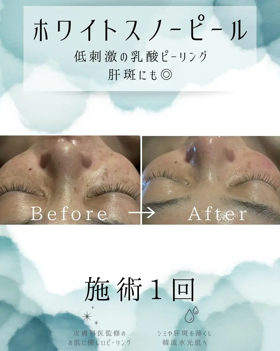 エステ リラク 医療提携 肌管理痩身エステ池袋のエステ・リラクイメージ