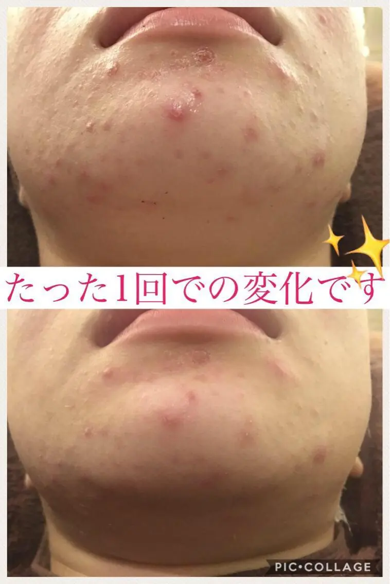 ミディアム カラー パーマ ヘアアレンジ メンズ キッズ ネイル マツエク・マツパ ニキビ・肌質改善専門 ♡人生が変わるサロンのエステ・リラクイメージ
