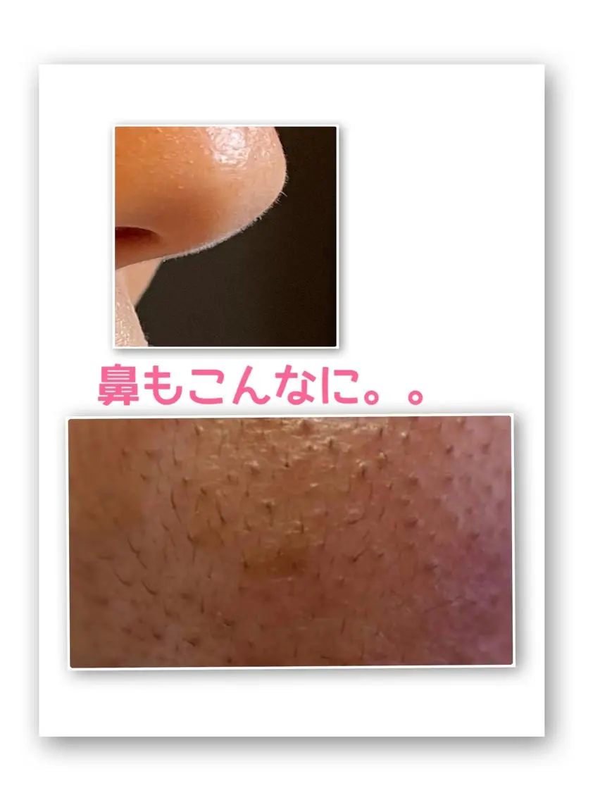 脱毛サロン mamanaのエステ・リラクイメージ