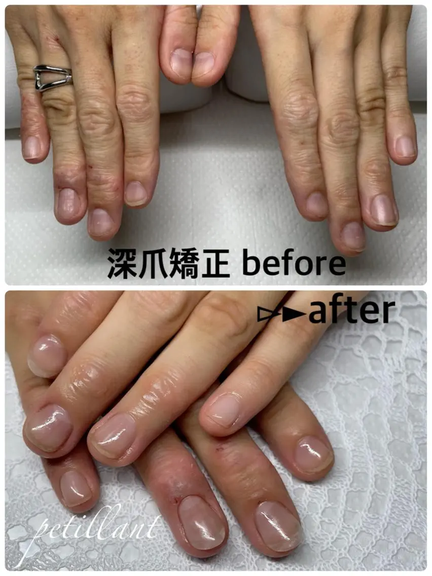 ネイル 長さ出し ピンク nail salon petillantのネイルデザイン
