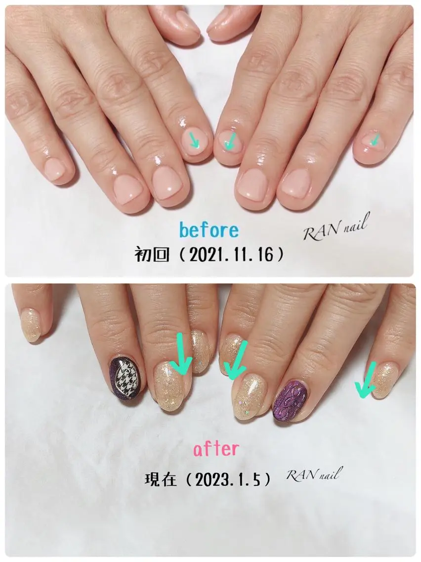 ネイル クリアネイル 成人式 フレンチネイル ジェルネイル ラメ(グリッター) ハンドネイル フットネイル RAN nailのネイルデザイン