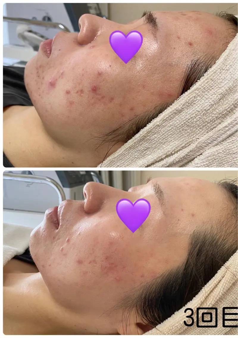 エステ COCO beautyサロンのエステ・リラクイメージ