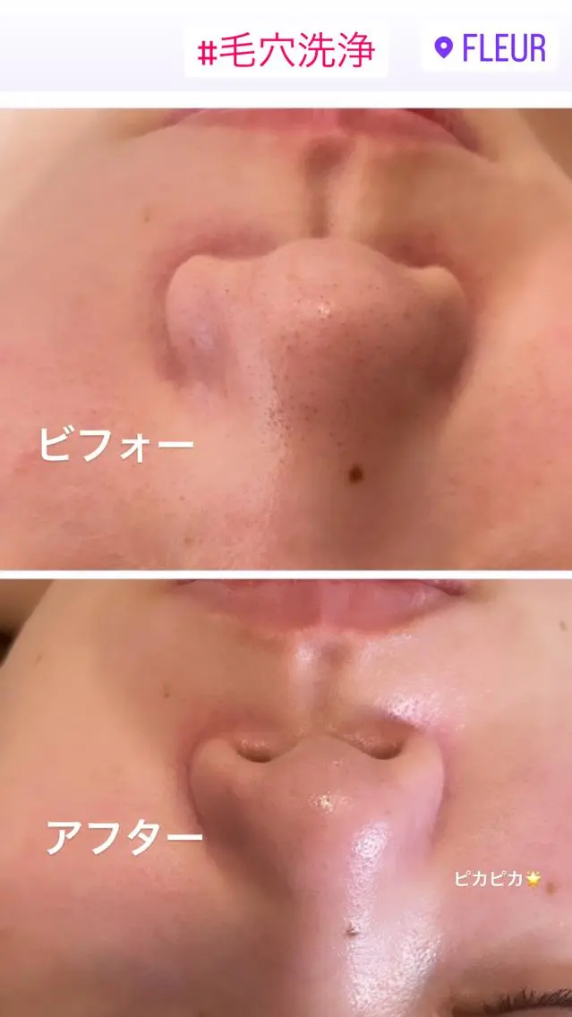 エステ FLEURフェイシャ ル🫧ハーブ🌿小顔のエステ・リラクイメージ