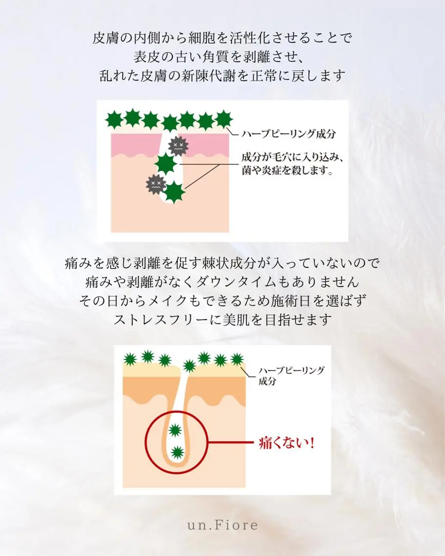 小顔ハーブピーリング un.Fiore🌷のエステ・リラクイメージ