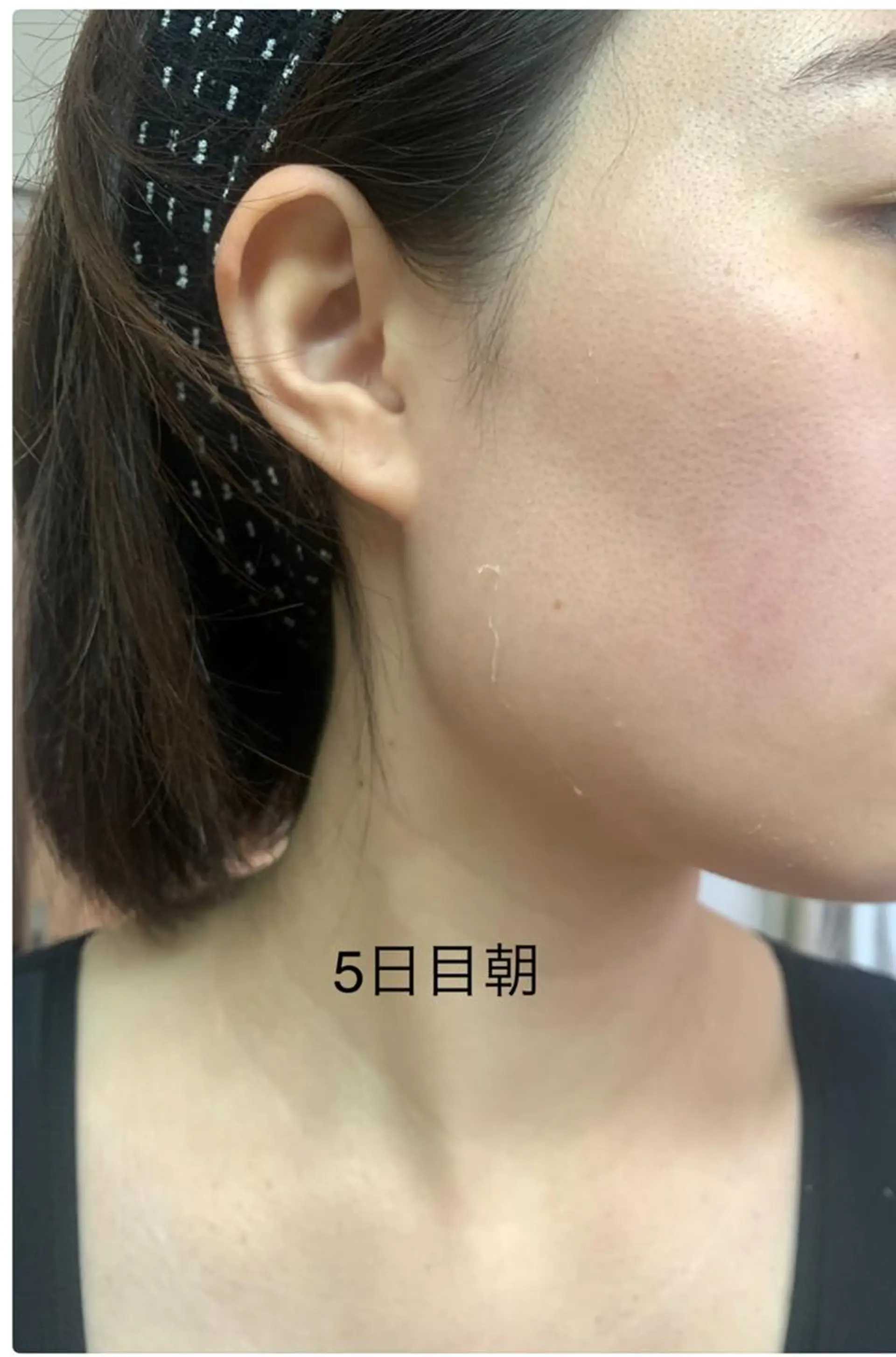 エステ リラク エステティック RAYVIS池袋🐱のエステ・リラクイメージ