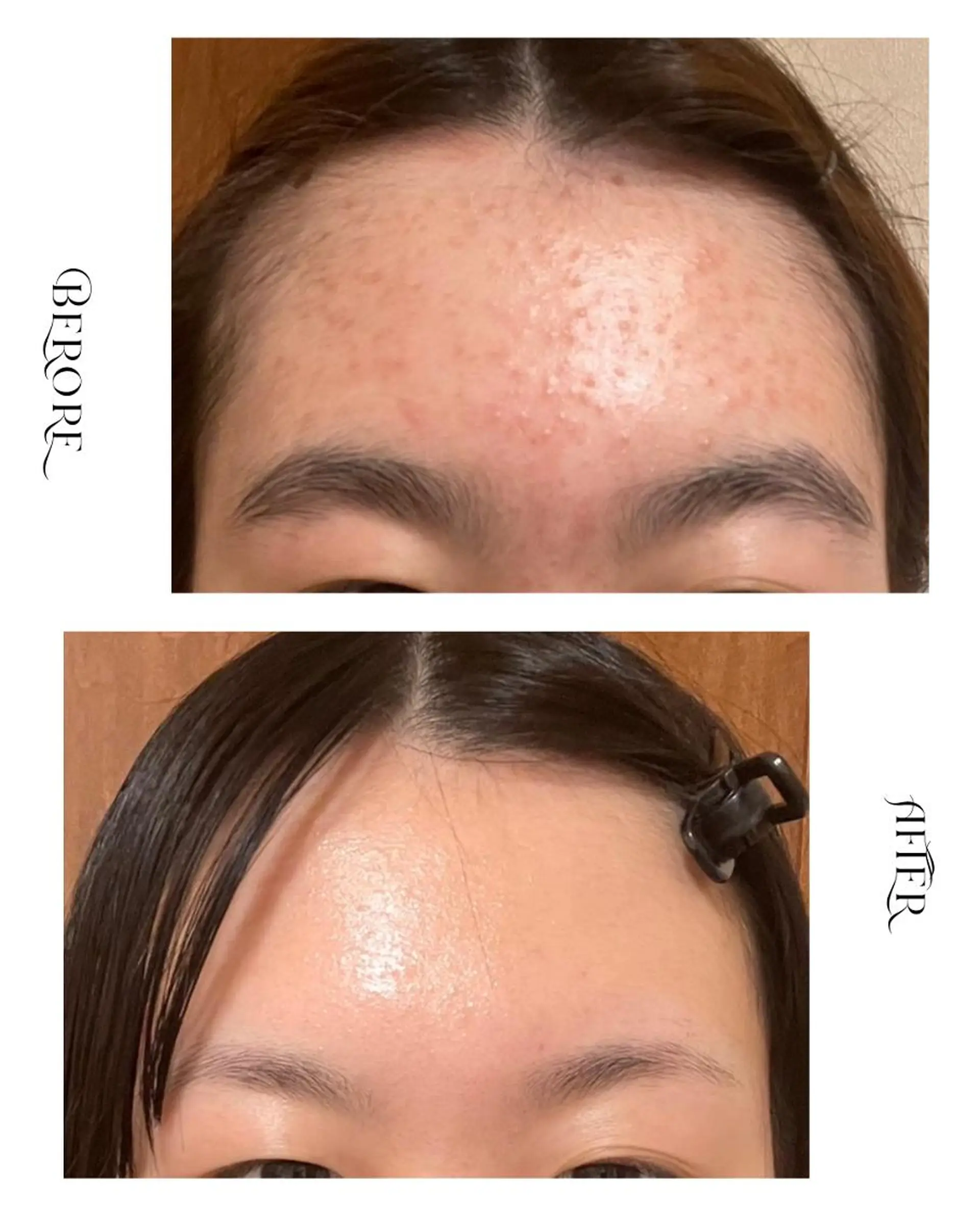 脱毛・肌質改善サロン Linoのエステ・リラクイメージ