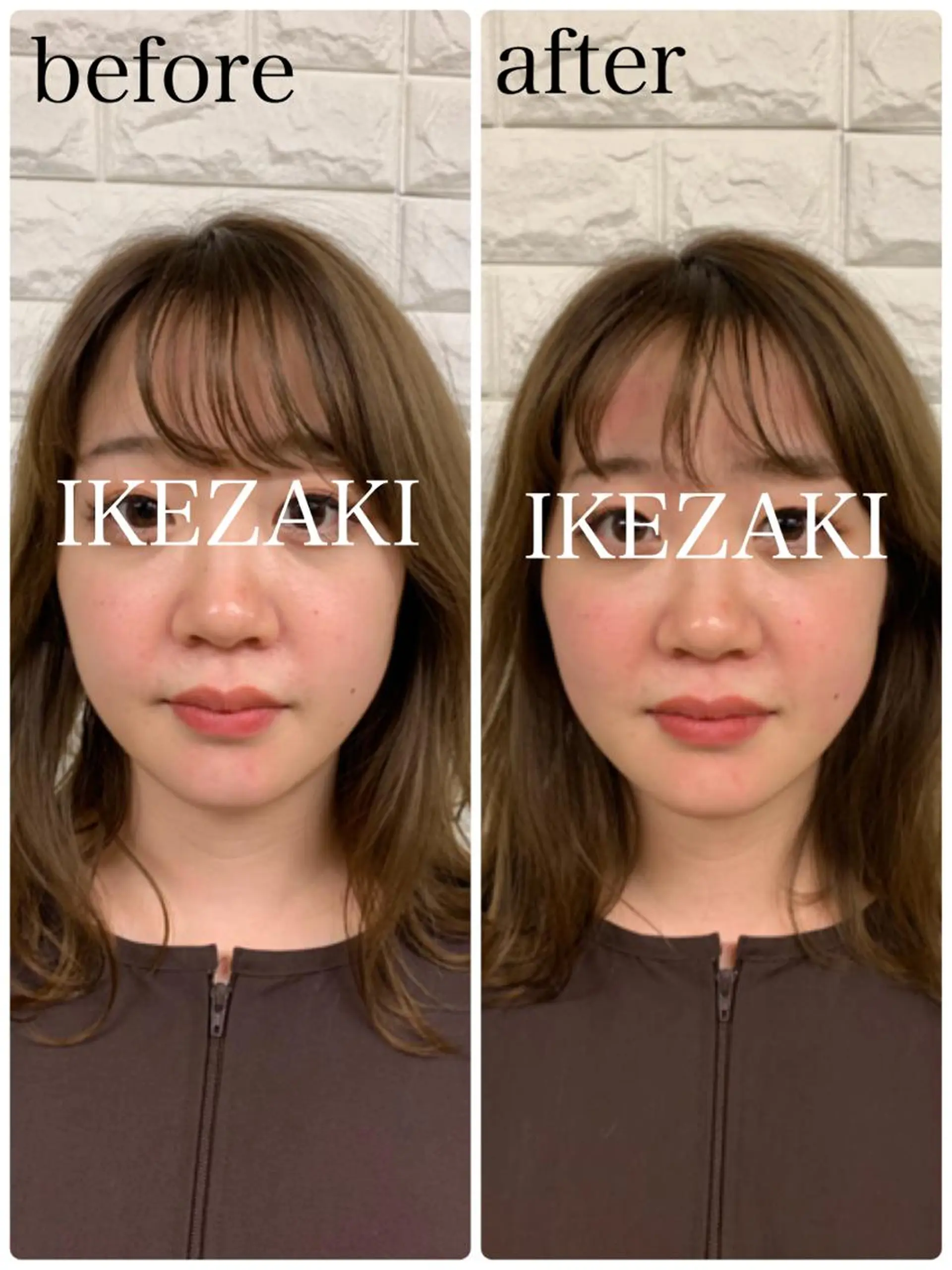 美容鍼 IKEZAKIのエステ・リラクイメージ