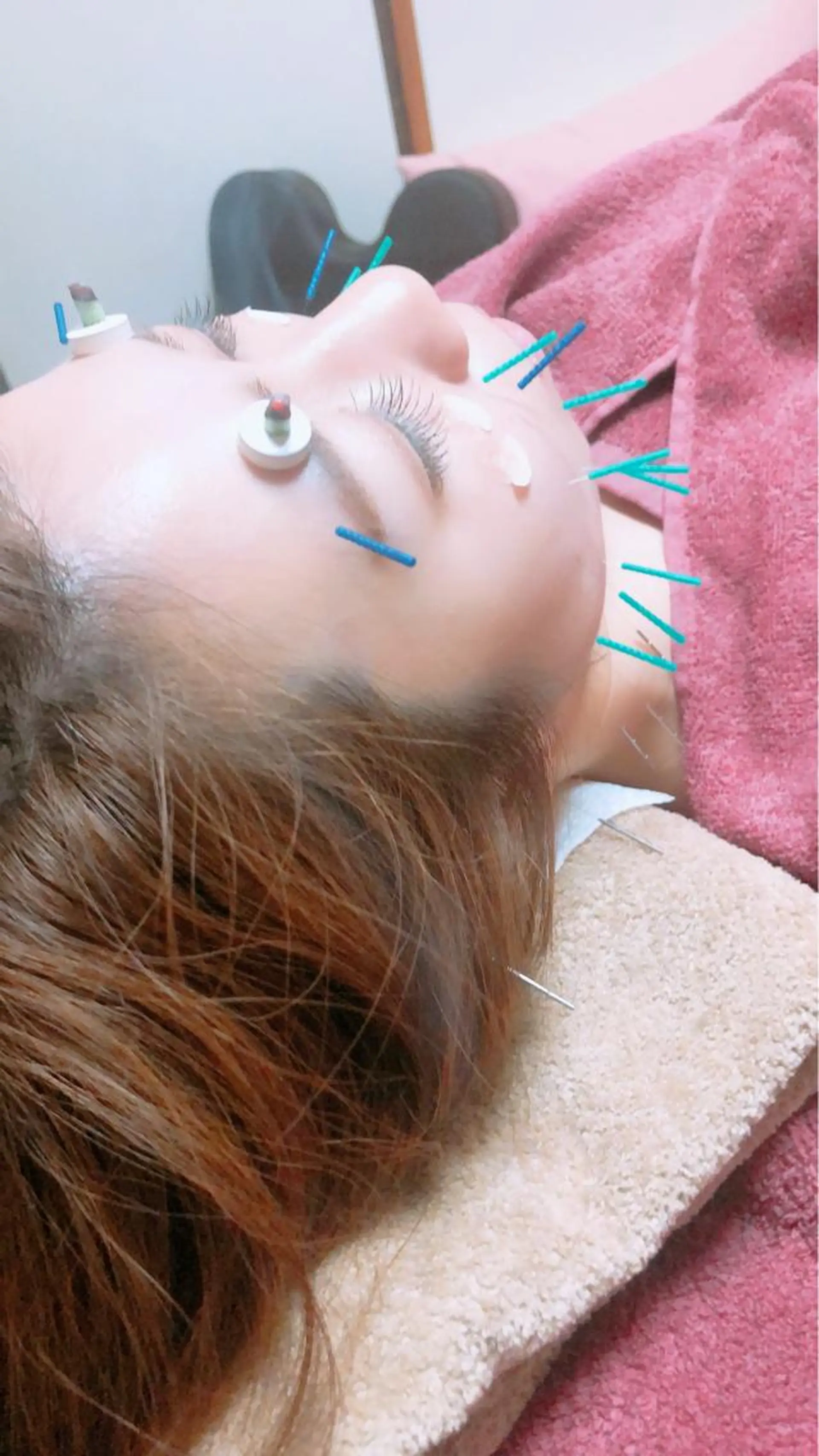 美容鍼灸女性専用 りんご鍼灸治療院のその他イメージ