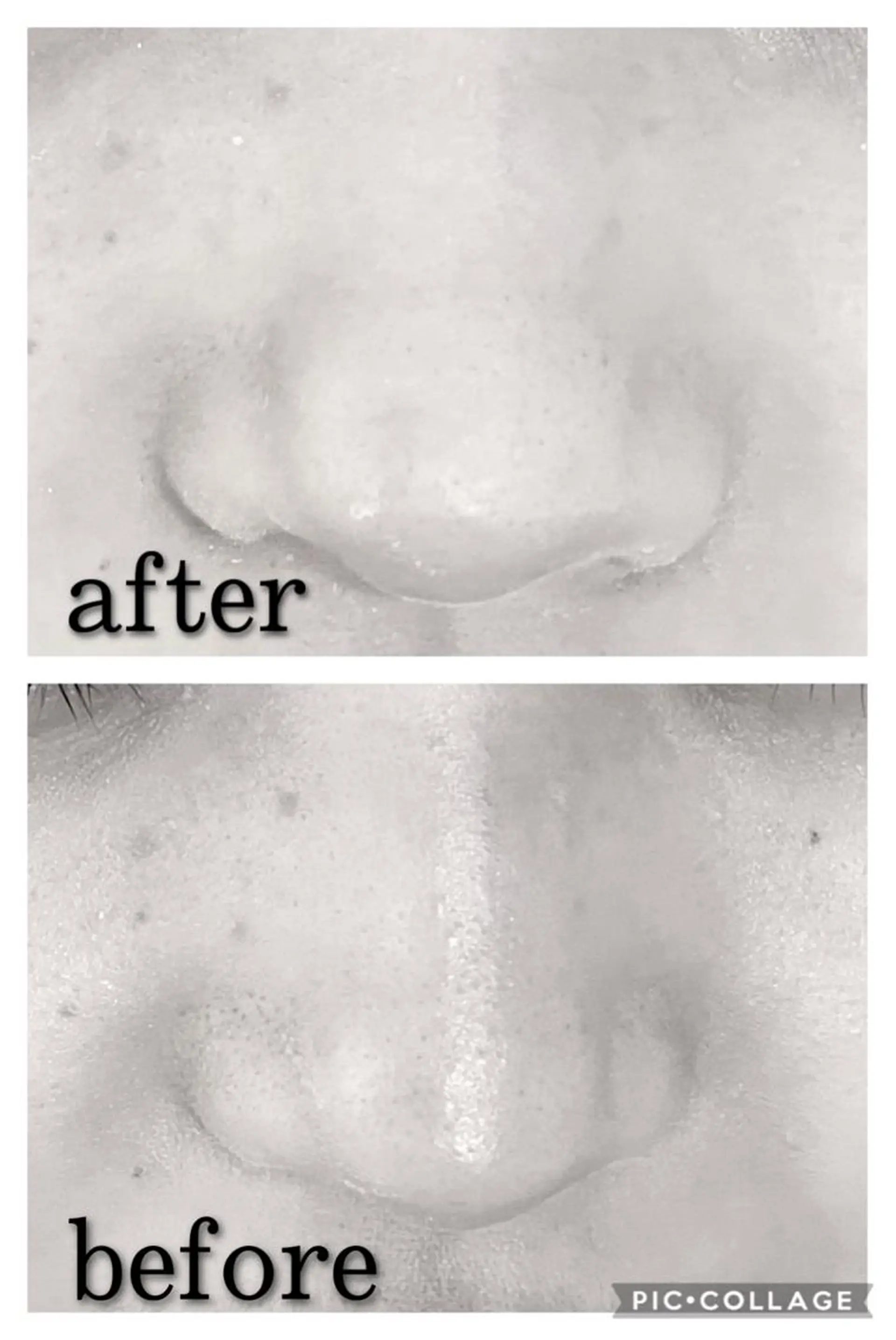 ミディアム カラー パーマ ヘアアレンジ メンズ キッズ ネイル マツエク・マツパ アイブロウ エステ リラク ニキビ特化型エステ 🍋最短で肌質改善のエステ・リラクイメージ