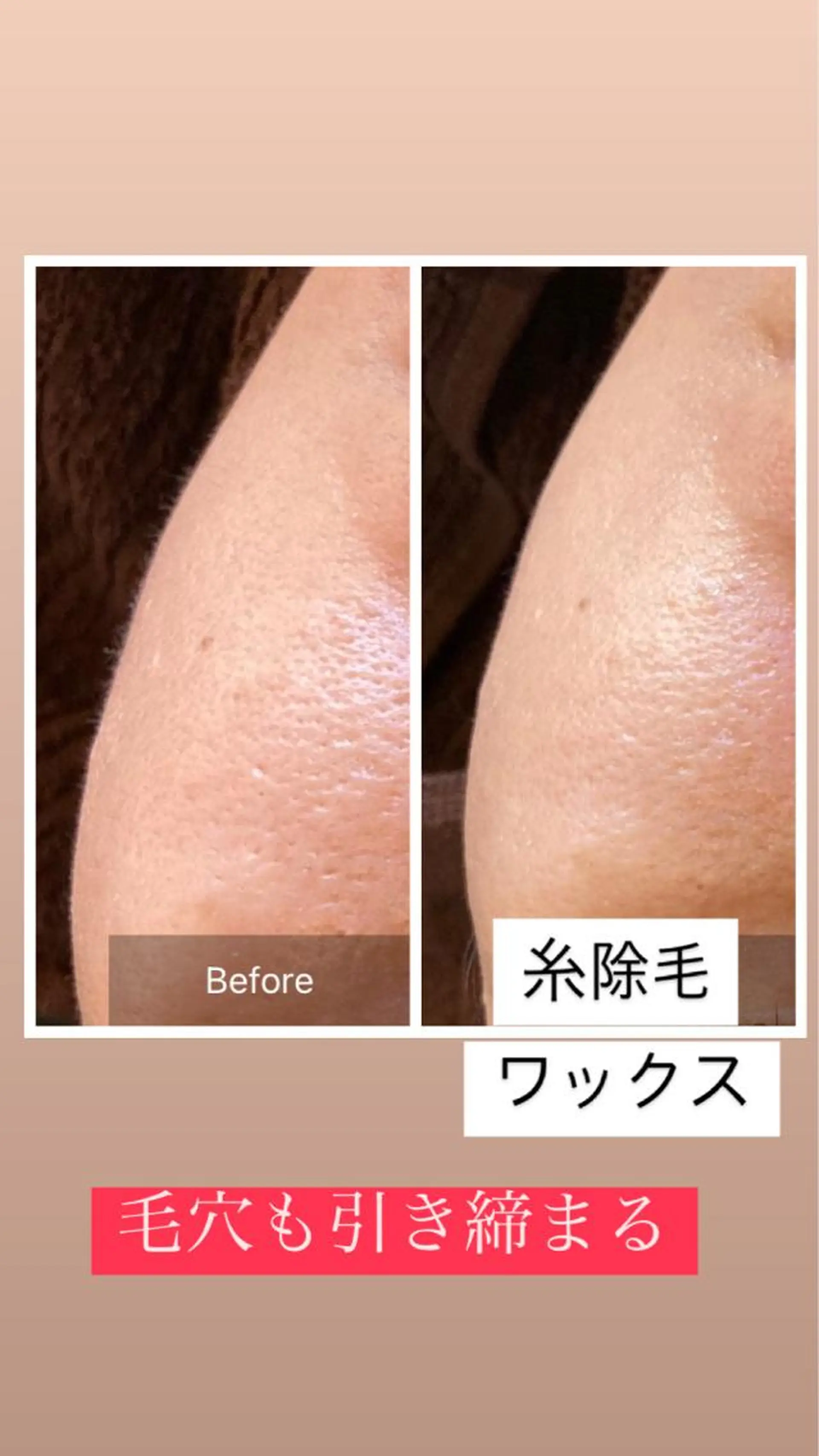 脱毛 産毛専門店 Bittoのエステ・リラクイメージ