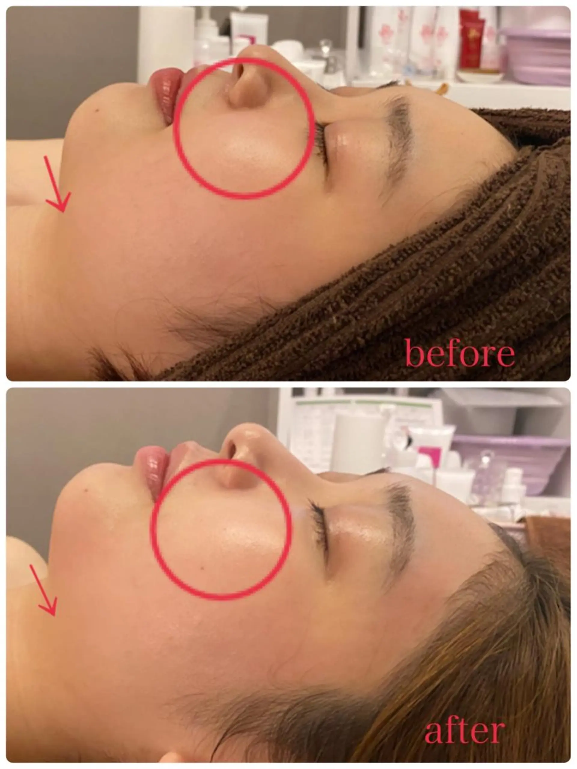 肌改善/まつげパーマ 🌙Luunaのエステ・リラクイメージ