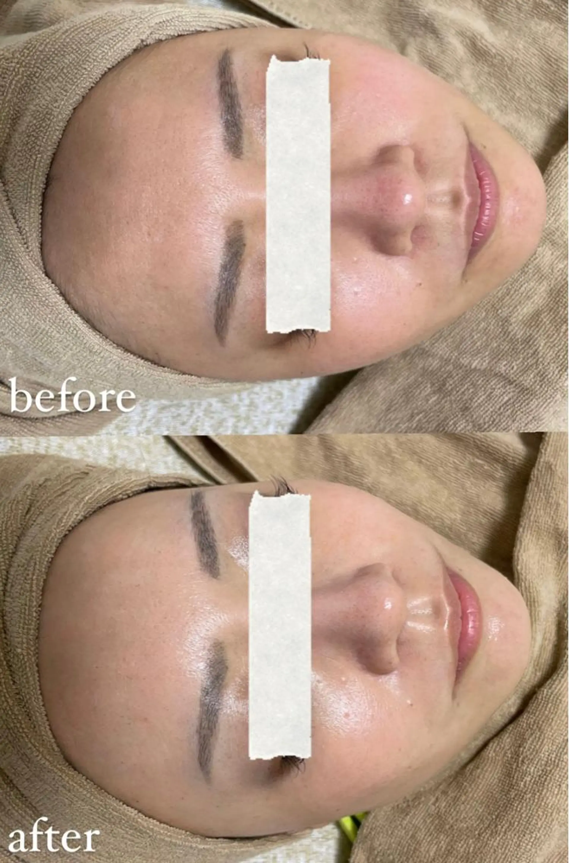 脱毛 エステサロン Mi-mi.iのエステ・リラクイメージ