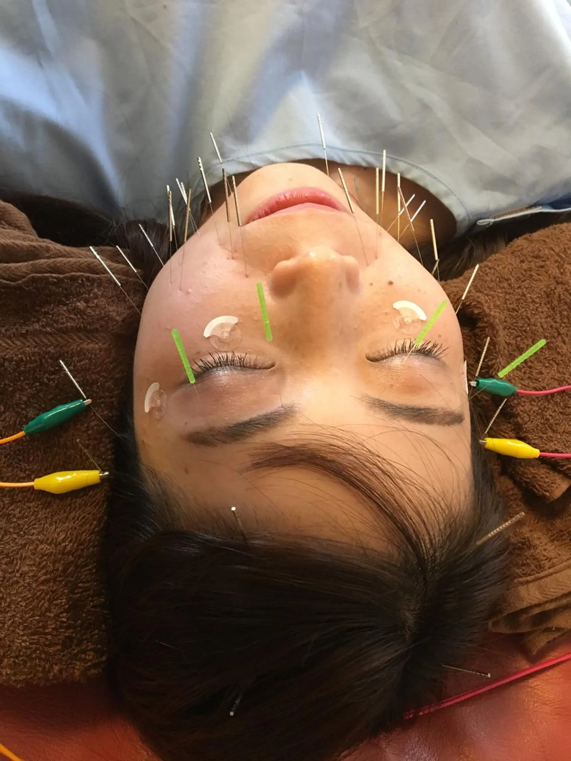 エステ リラク i鍼灸整体院所属・i鍼灸整体院 石井宏和のエステ・リラクイメージ