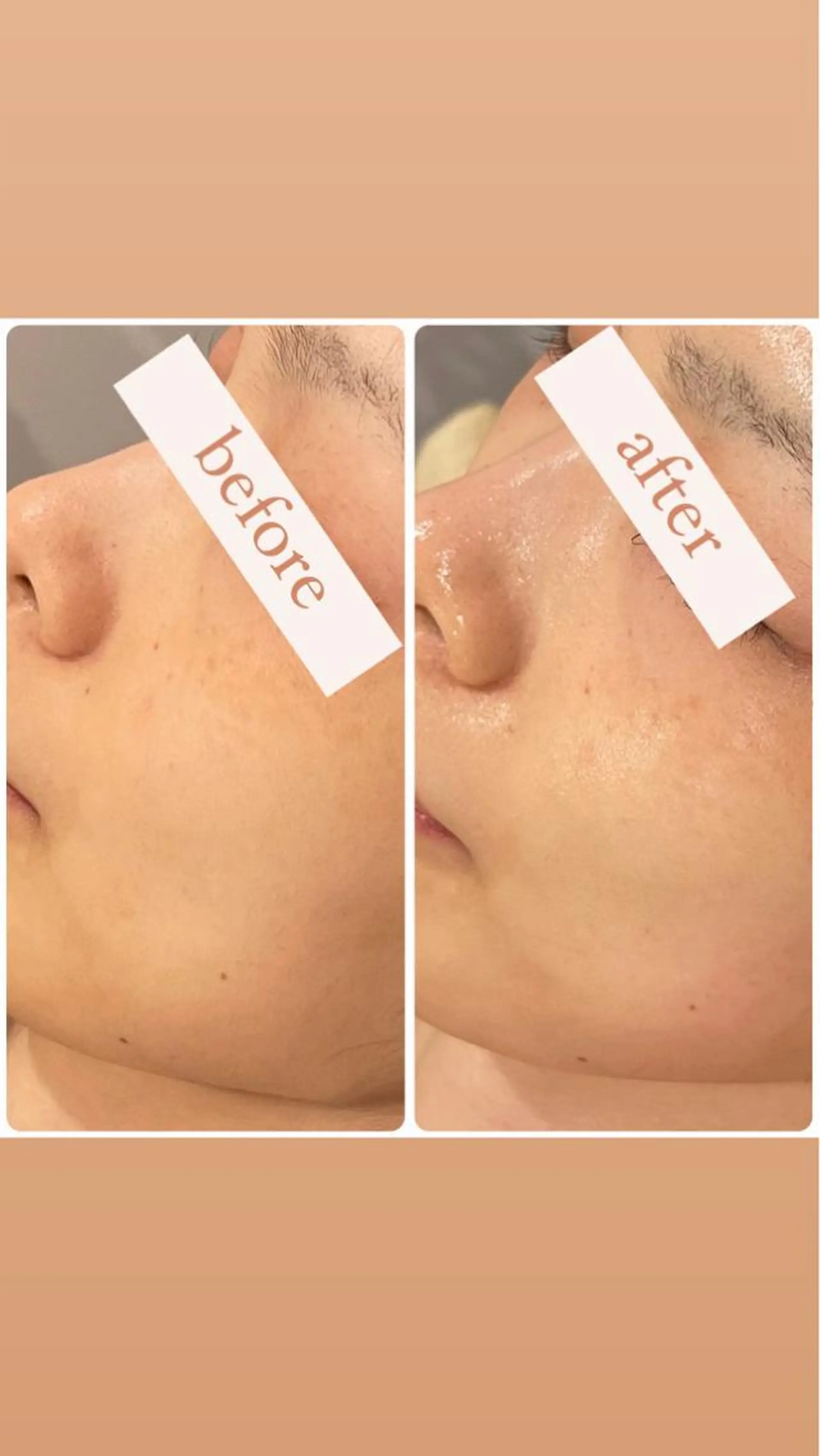 エステ リラク 立体小顔×艶肌×美ボ ディ似合わせ施術 岡のエステ・リラクイメージ