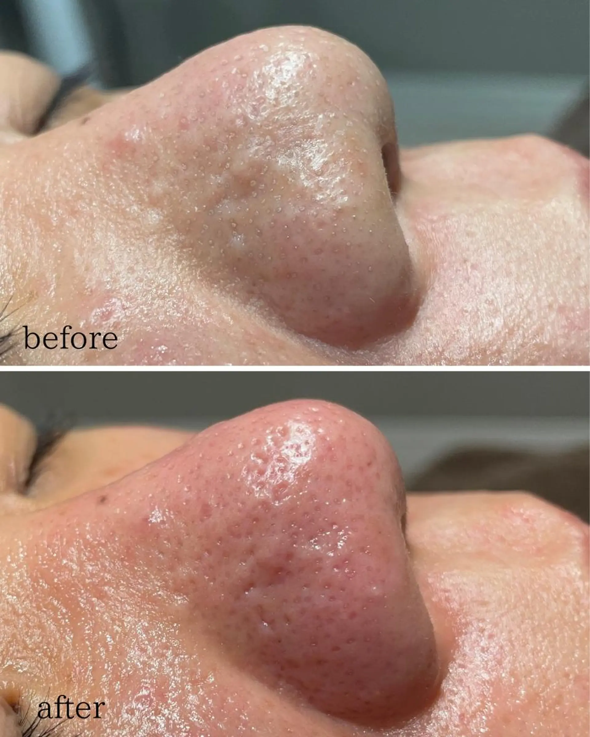 松下 千恵のネイルデザイン