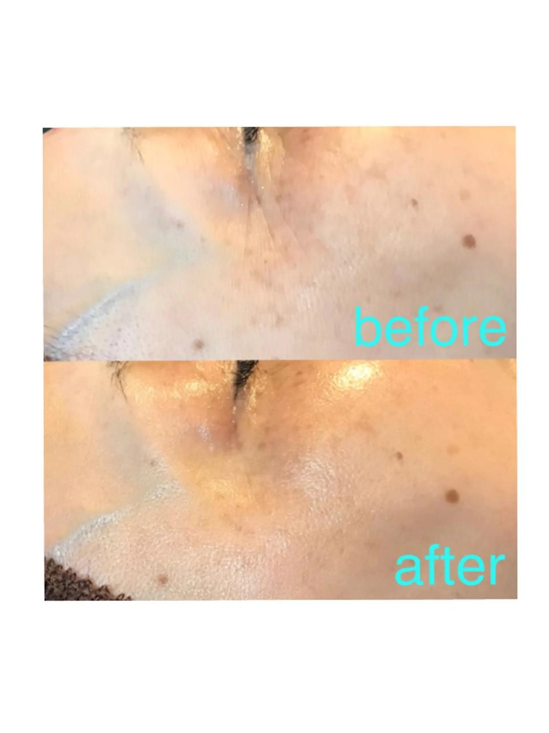 エステ 浜野 恵美のエステ・リラクイメージ