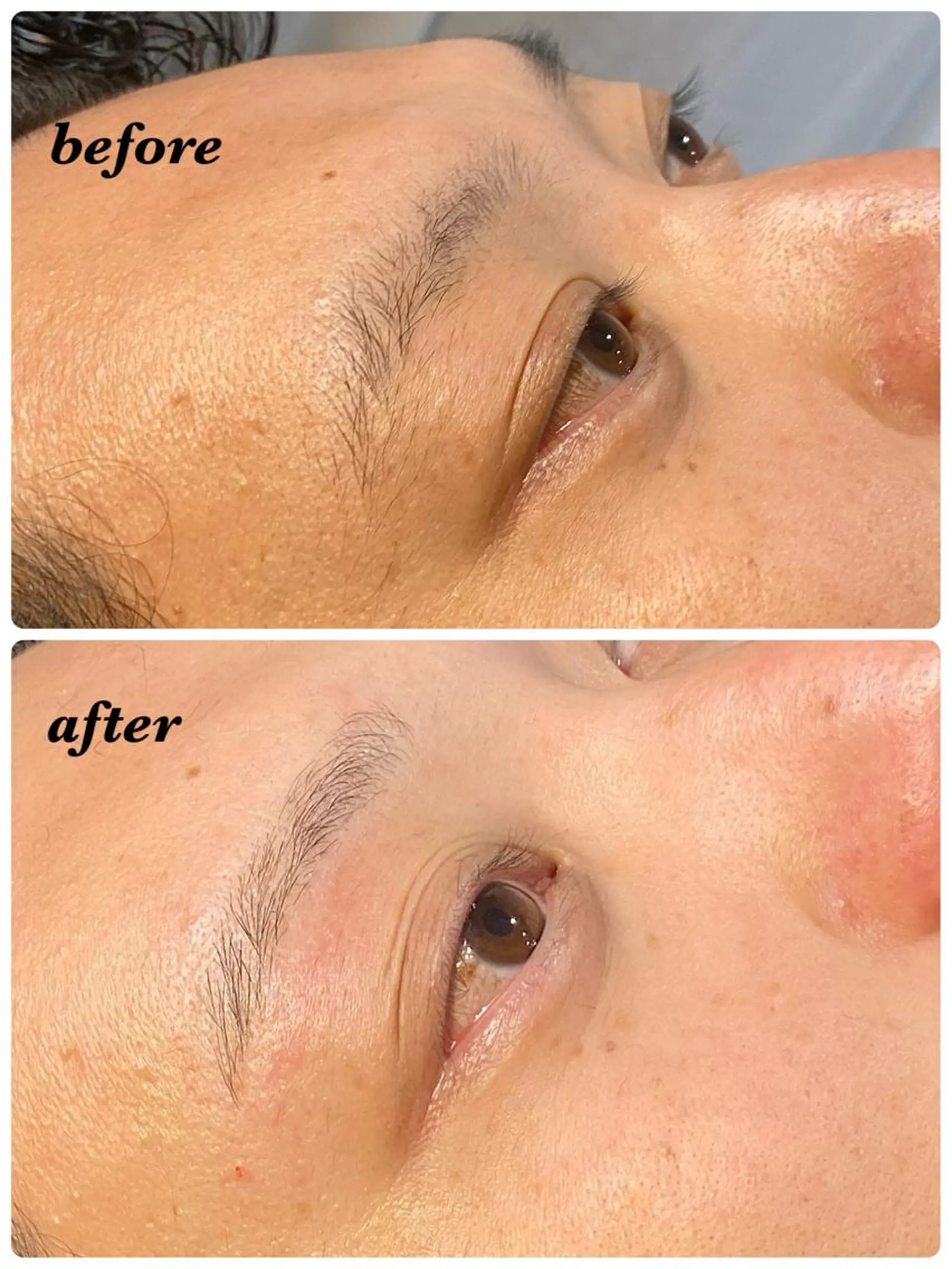 アイブロウ ハーブピーリング/韓国肌管理/フェイシャル/毛穴洗浄/眉毛/顔脱毛【糸脱毛専門】rev所属・ハーブピーリング専門 毛穴洗浄❤️眉waxのエステ・リラクイメージ