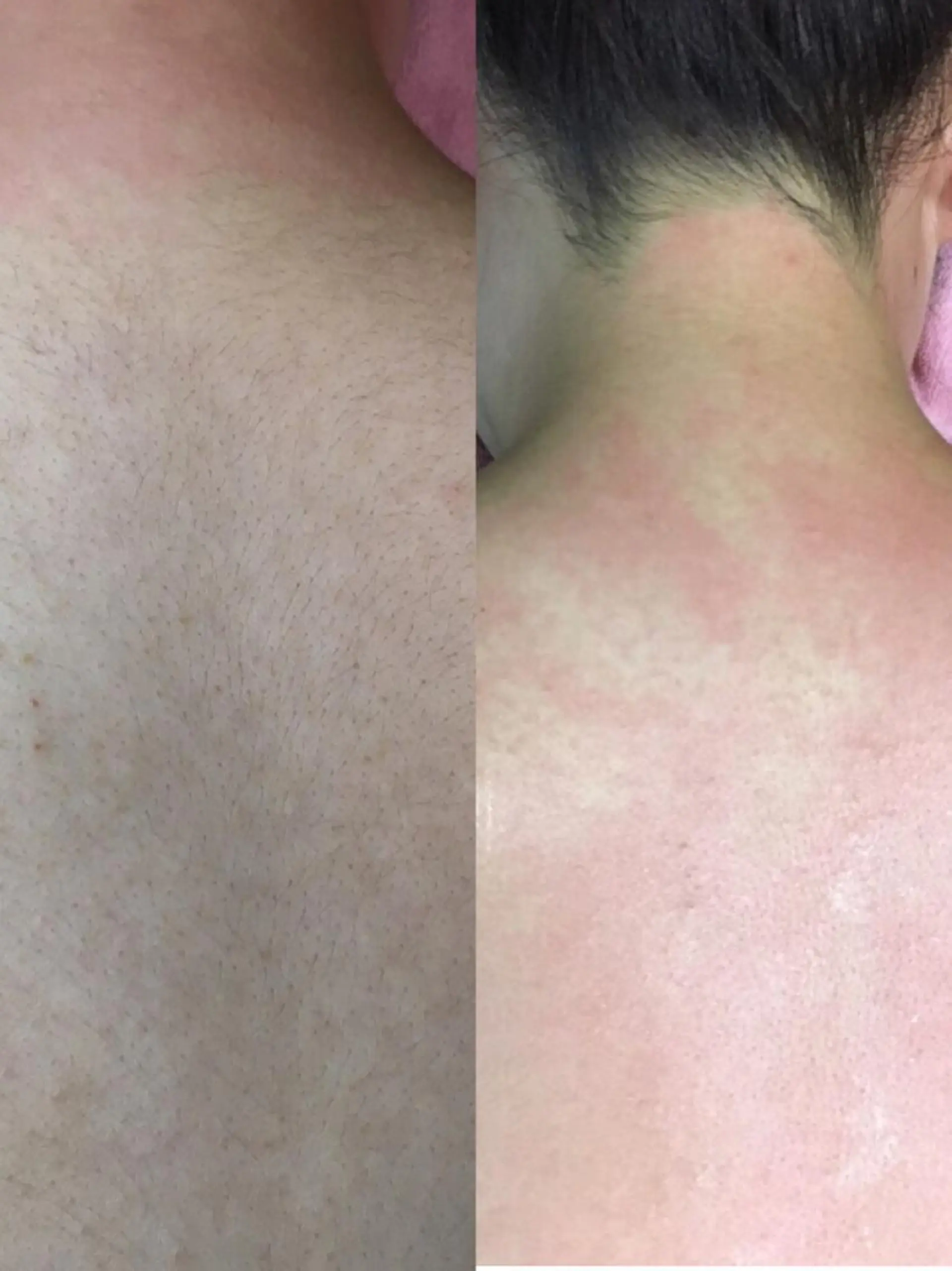 Puni 〜プーニー〜のエステ・リラクイメージ