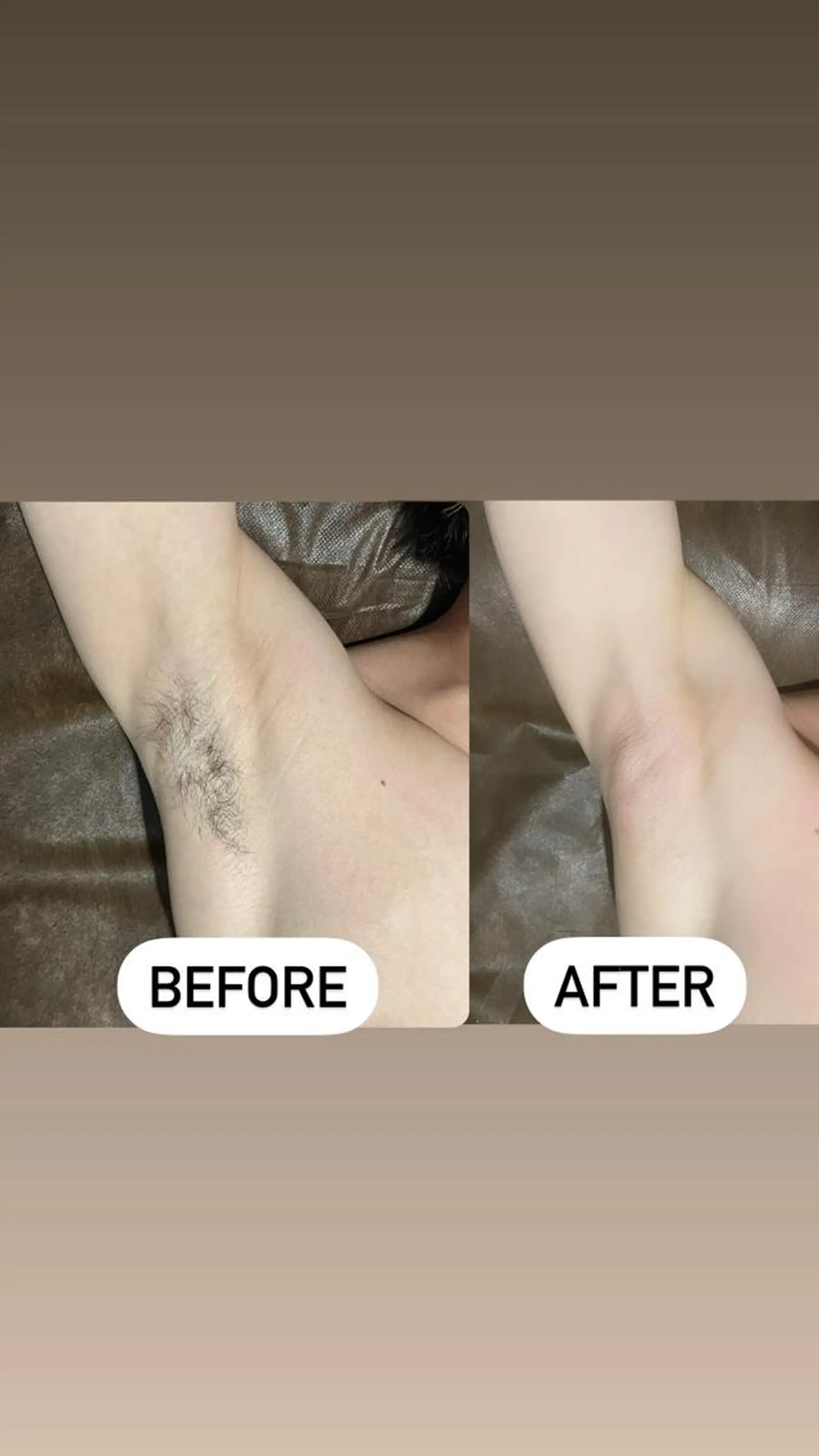 メンズ 脱毛 メンズ眉毛ITSUK Iメンズ専門　新宿の眉毛・アイブロウイメージ