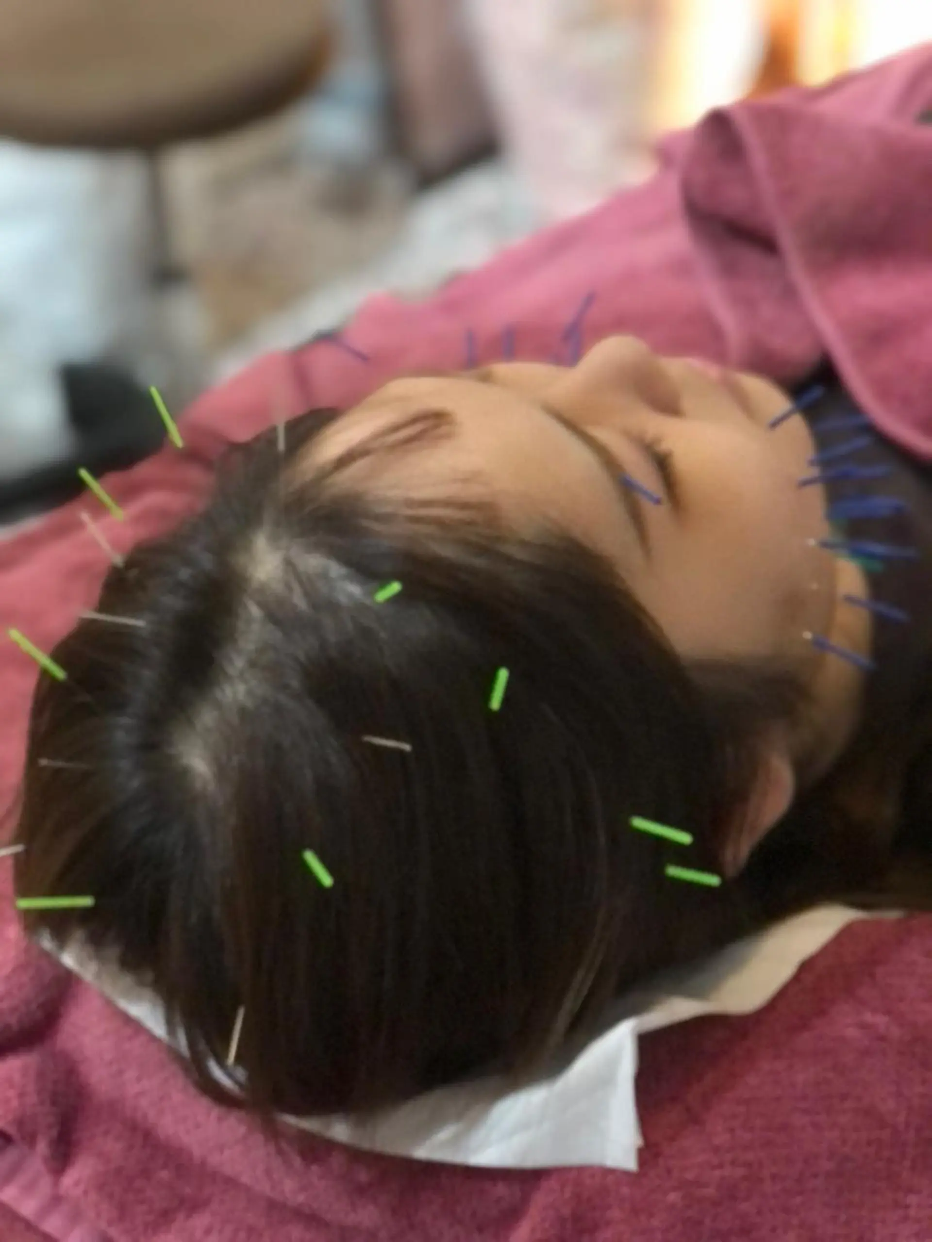 美容鍼灸女性専用 りんご鍼灸治療院のその他イメージ