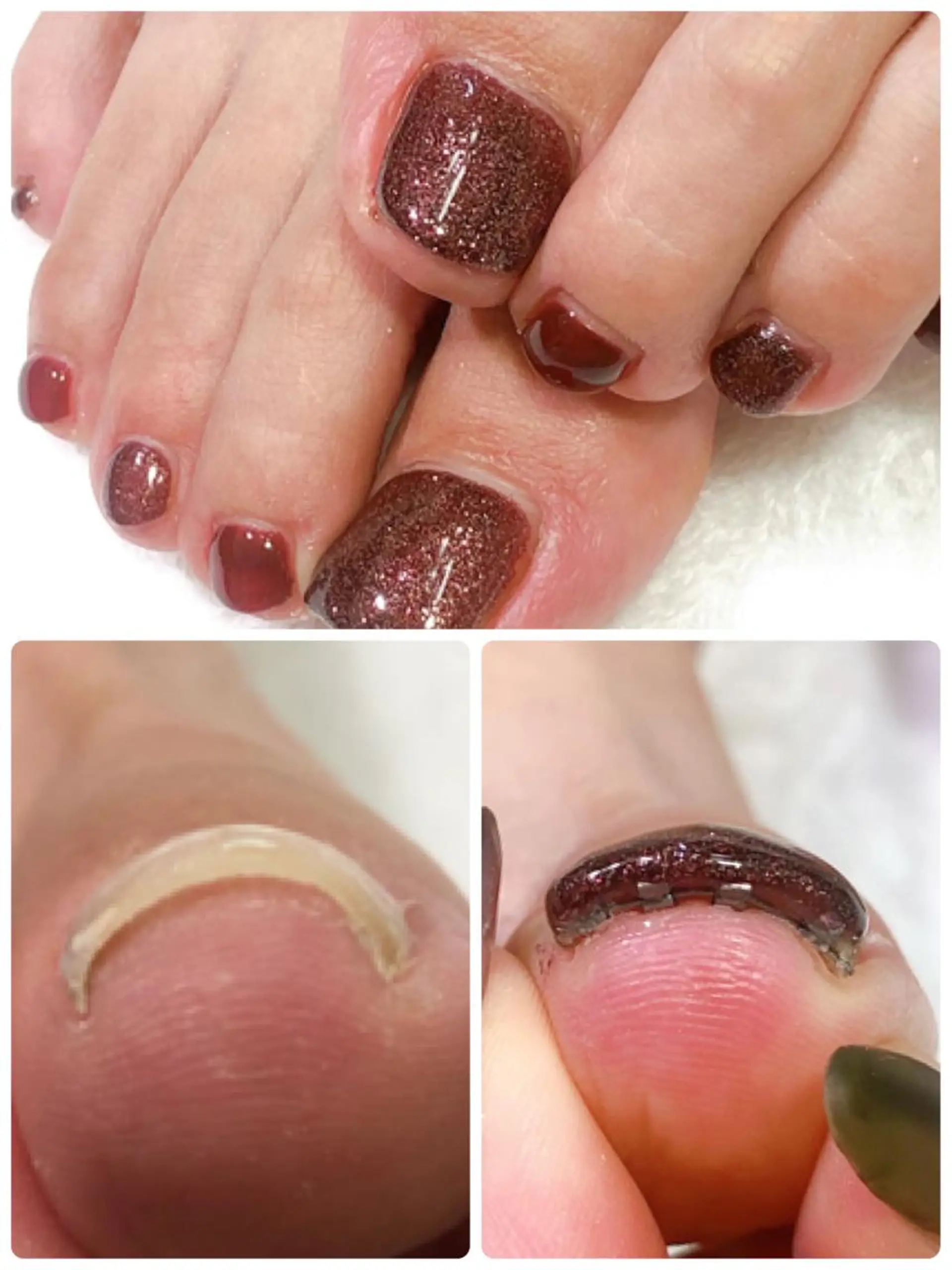 ネイル フットネイル K yukaのネイルデザイン