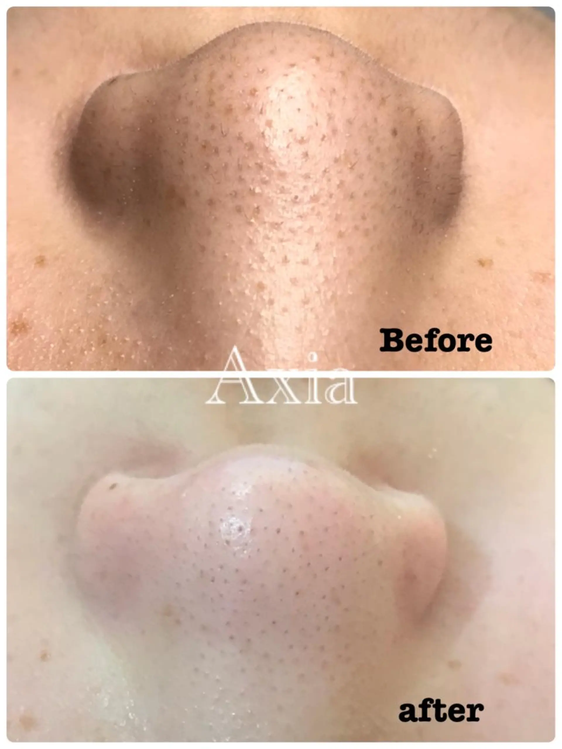 究極のアンチエイ ジングサロンのエステ・リラクイメージ