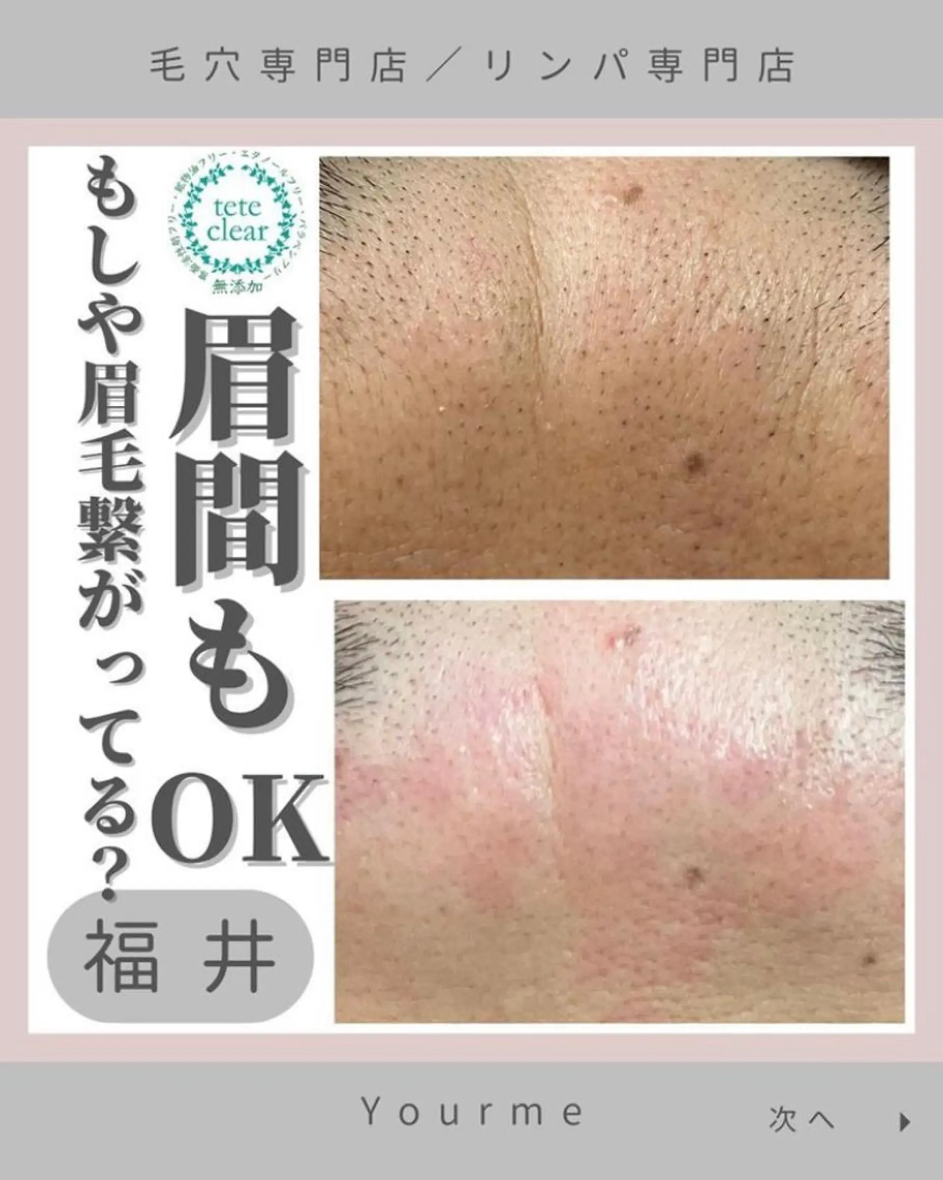 毛穴肌質ケアサロン Yourmeユアミーのエステ・リラクイメージ