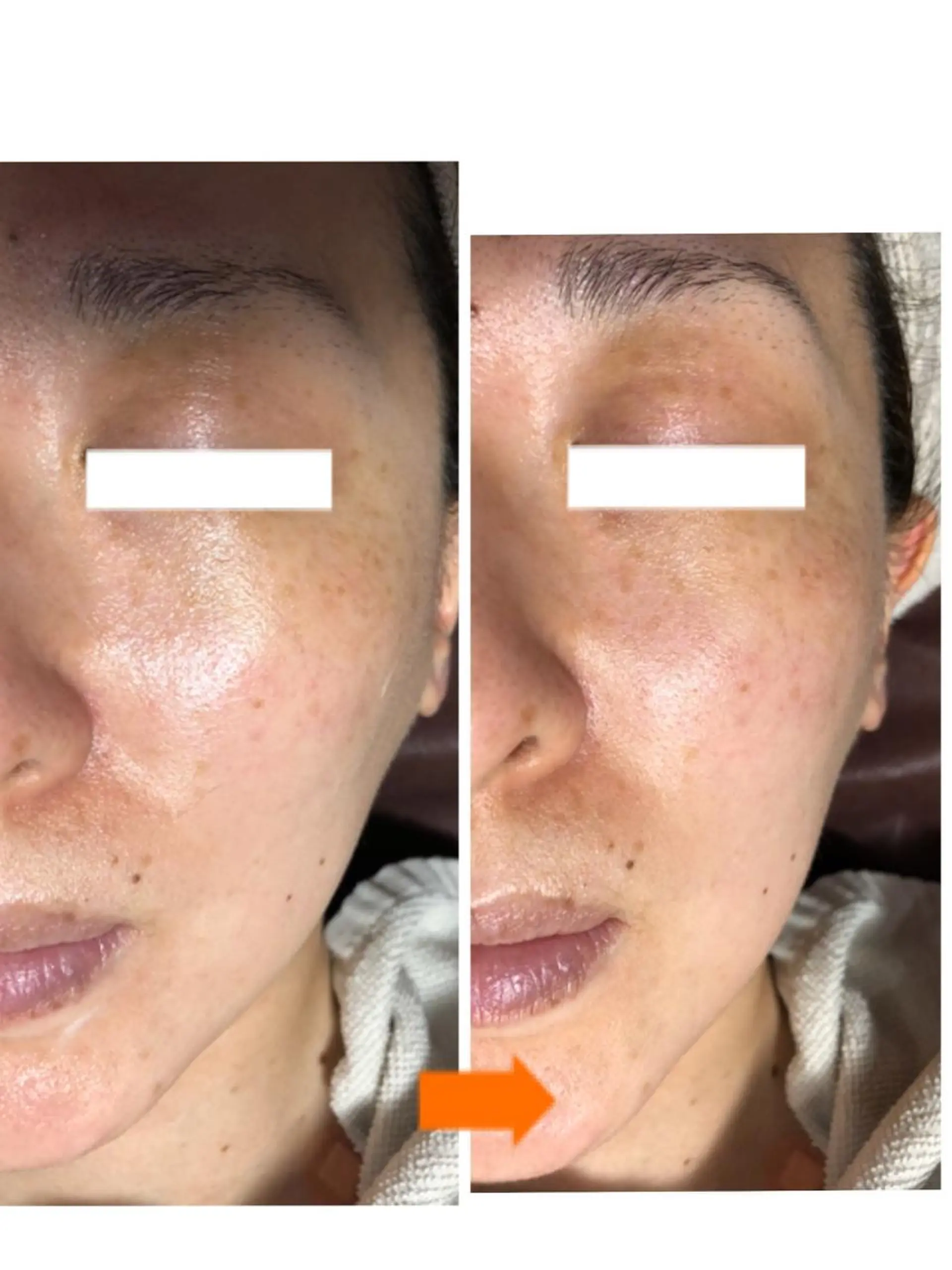 エステ 小顔・毛穴・たるみ ネイル　似内真樹のエステ・リラクイメージ