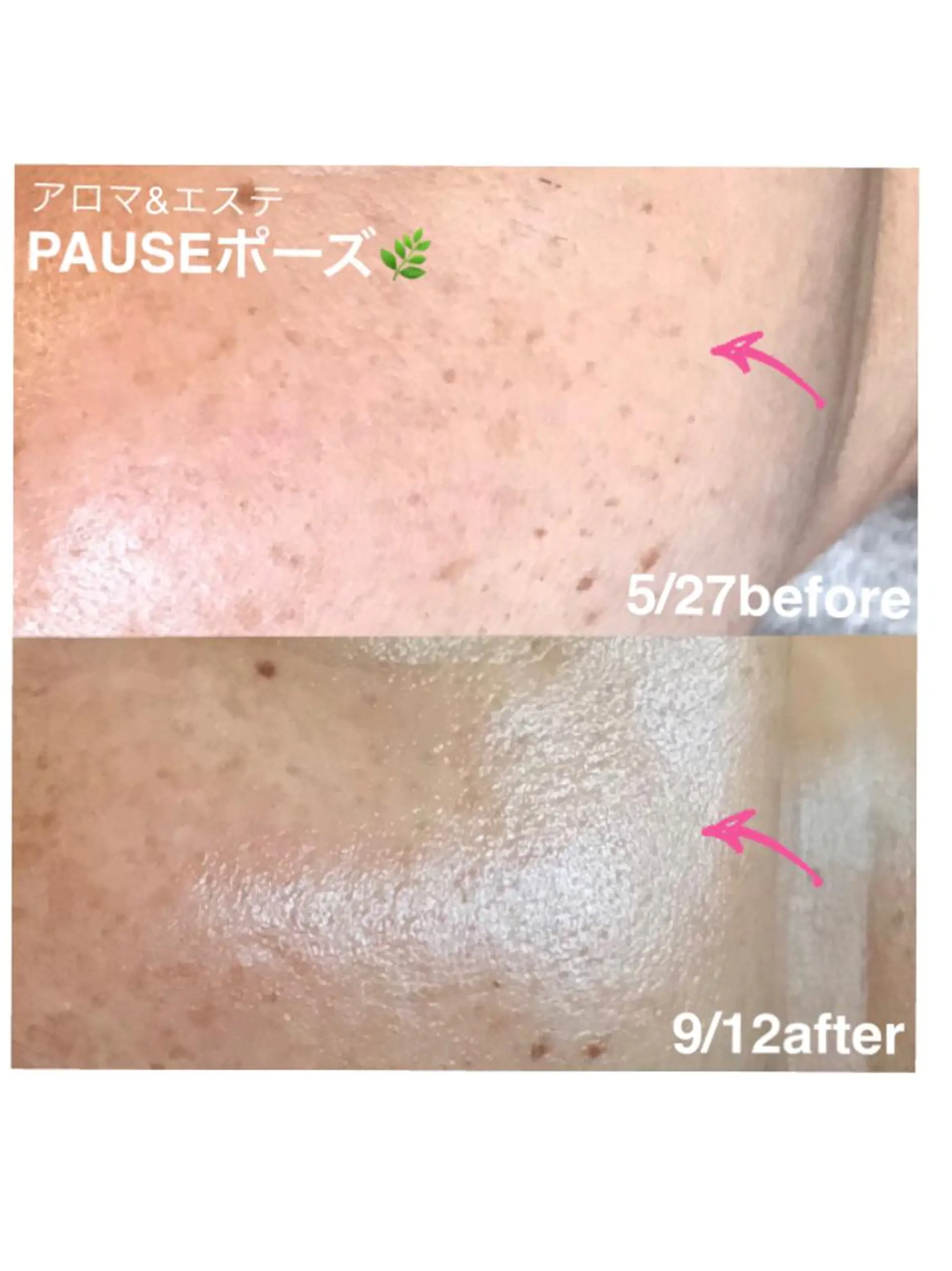 エステ 浜野 恵美のエステ・リラクイメージ