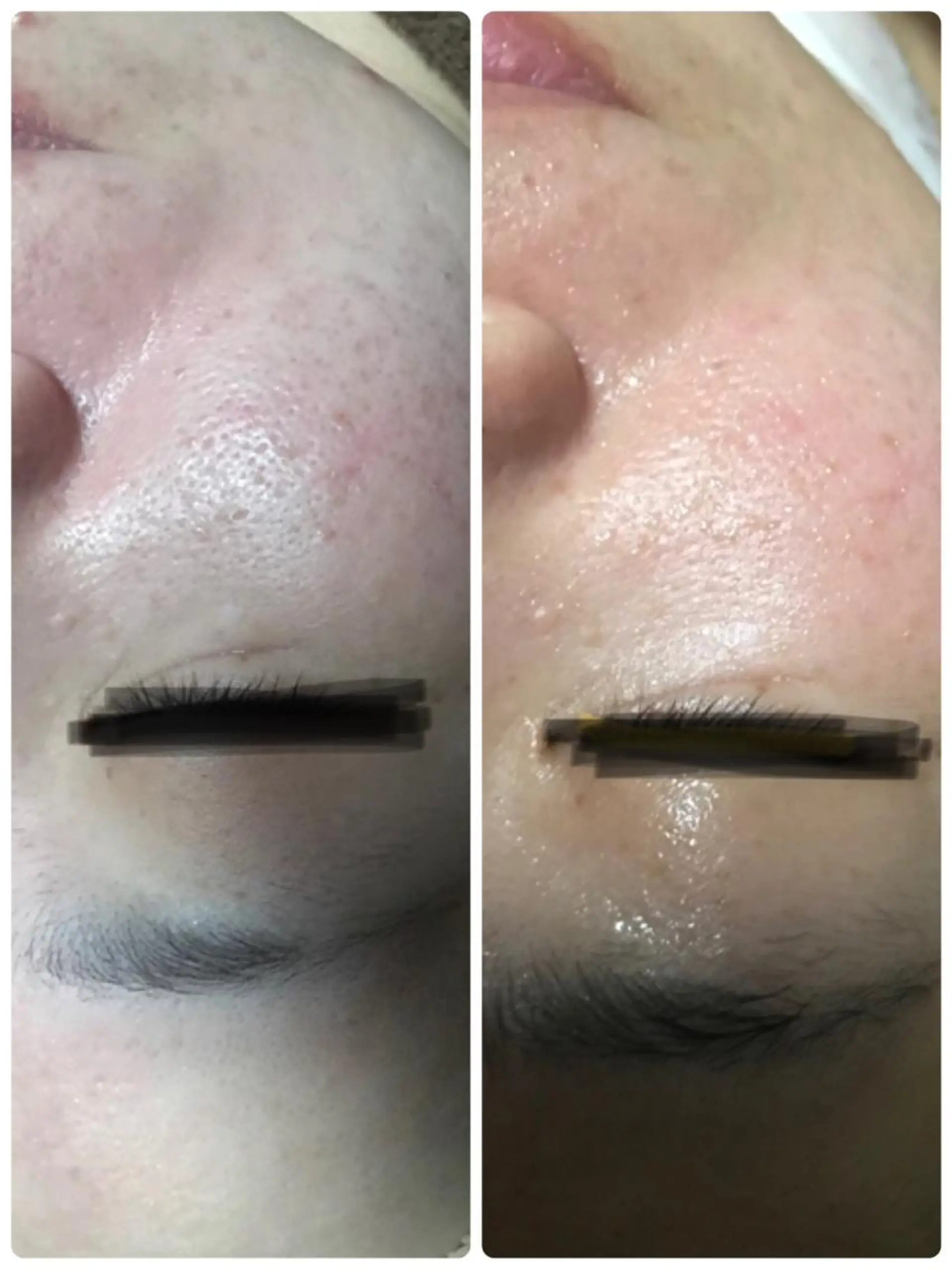 エステ トータルエステサロン Tiaraのエステ・リラクイメージ