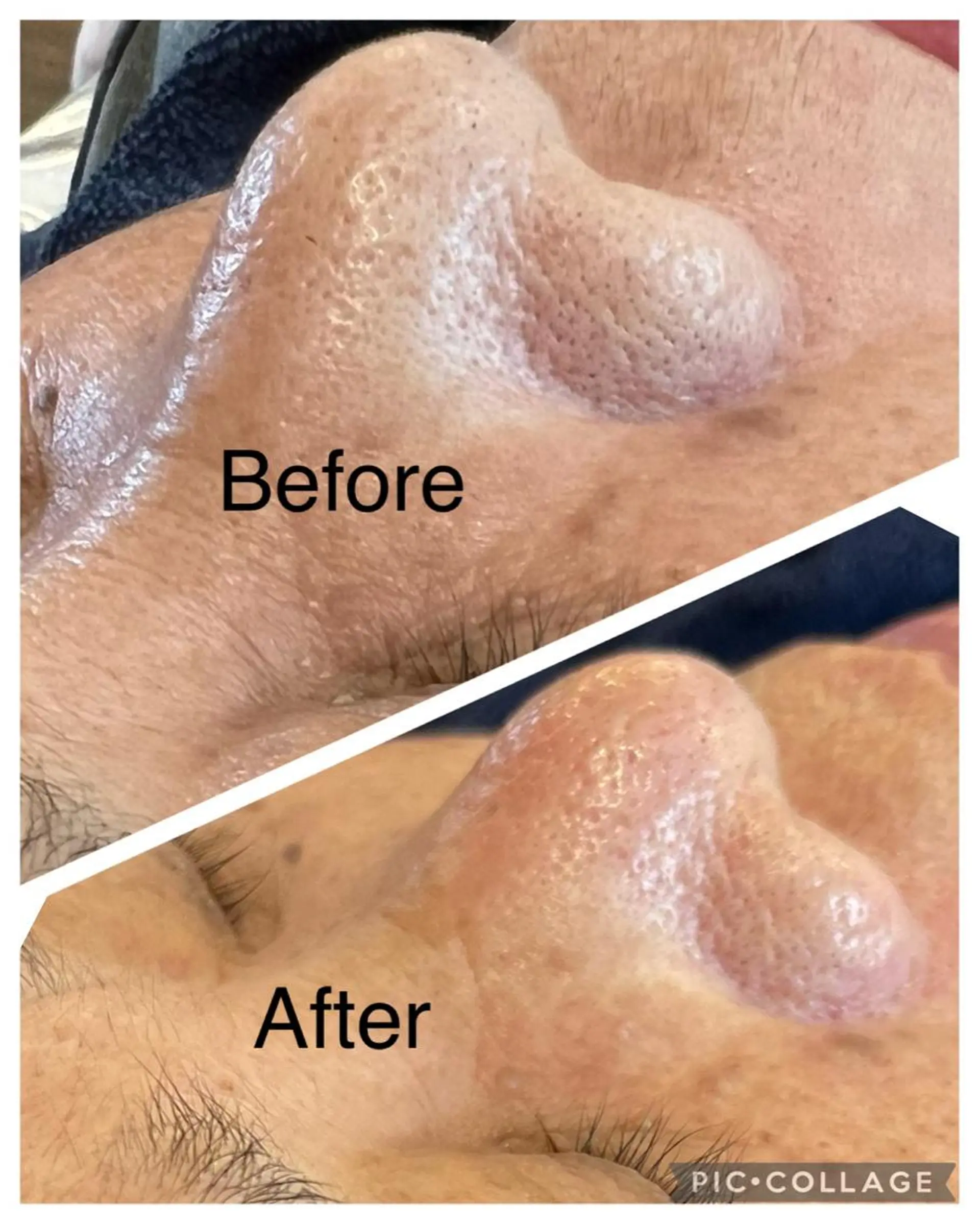 エステ 宇野澤 彩加のエステ・リラクイメージ