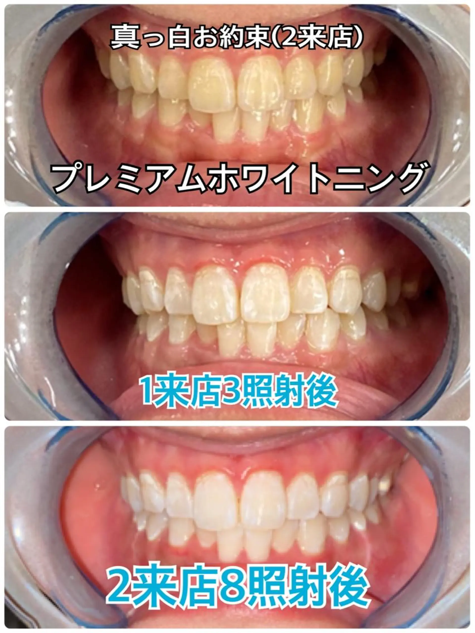 Platinum Beauty 四条烏丸店所属・吉田亮利 ホワイトニング専門店のその他イメージ