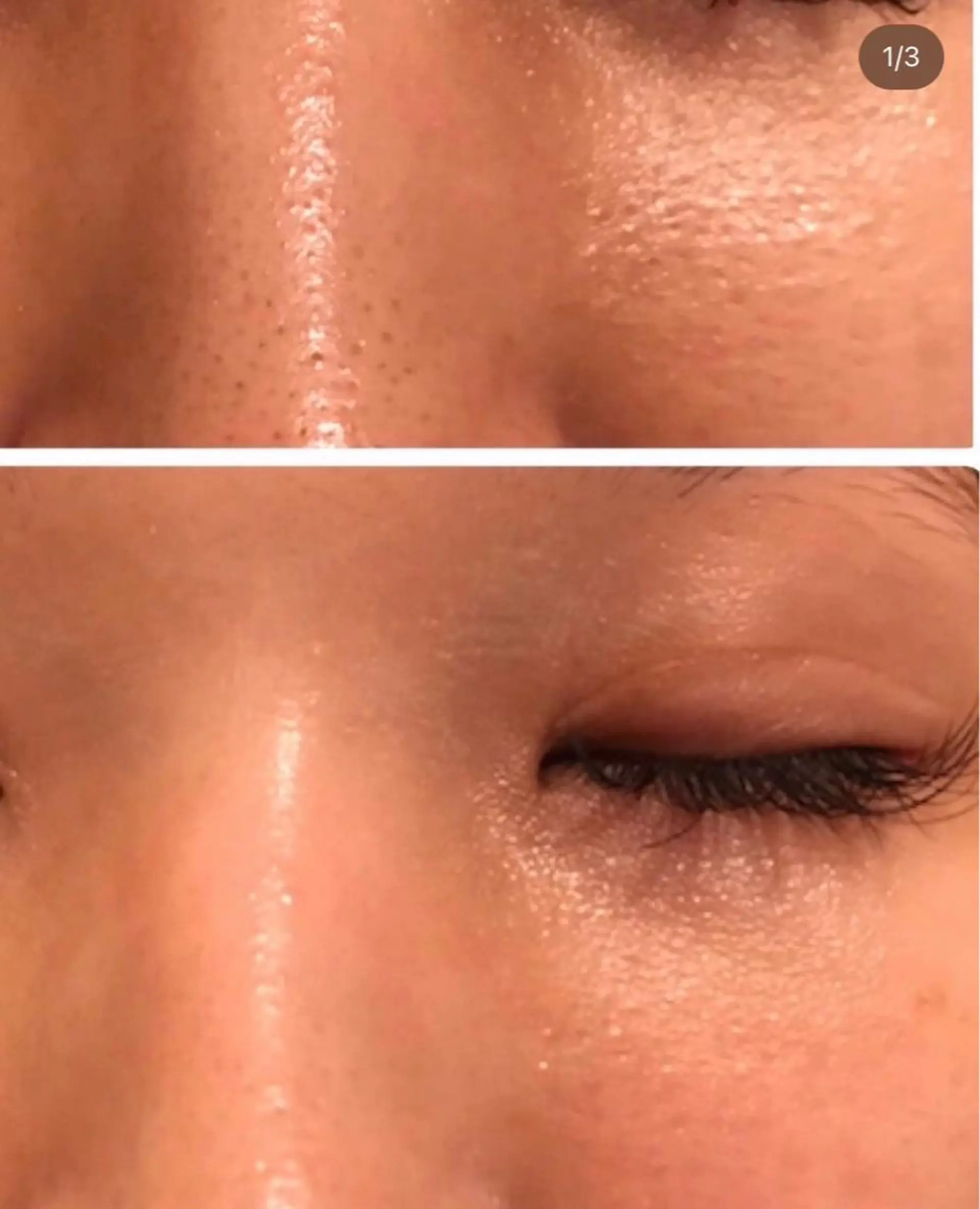 y.laBelle 艶肌・小顔・肌質改善のエステ・リラクイメージ