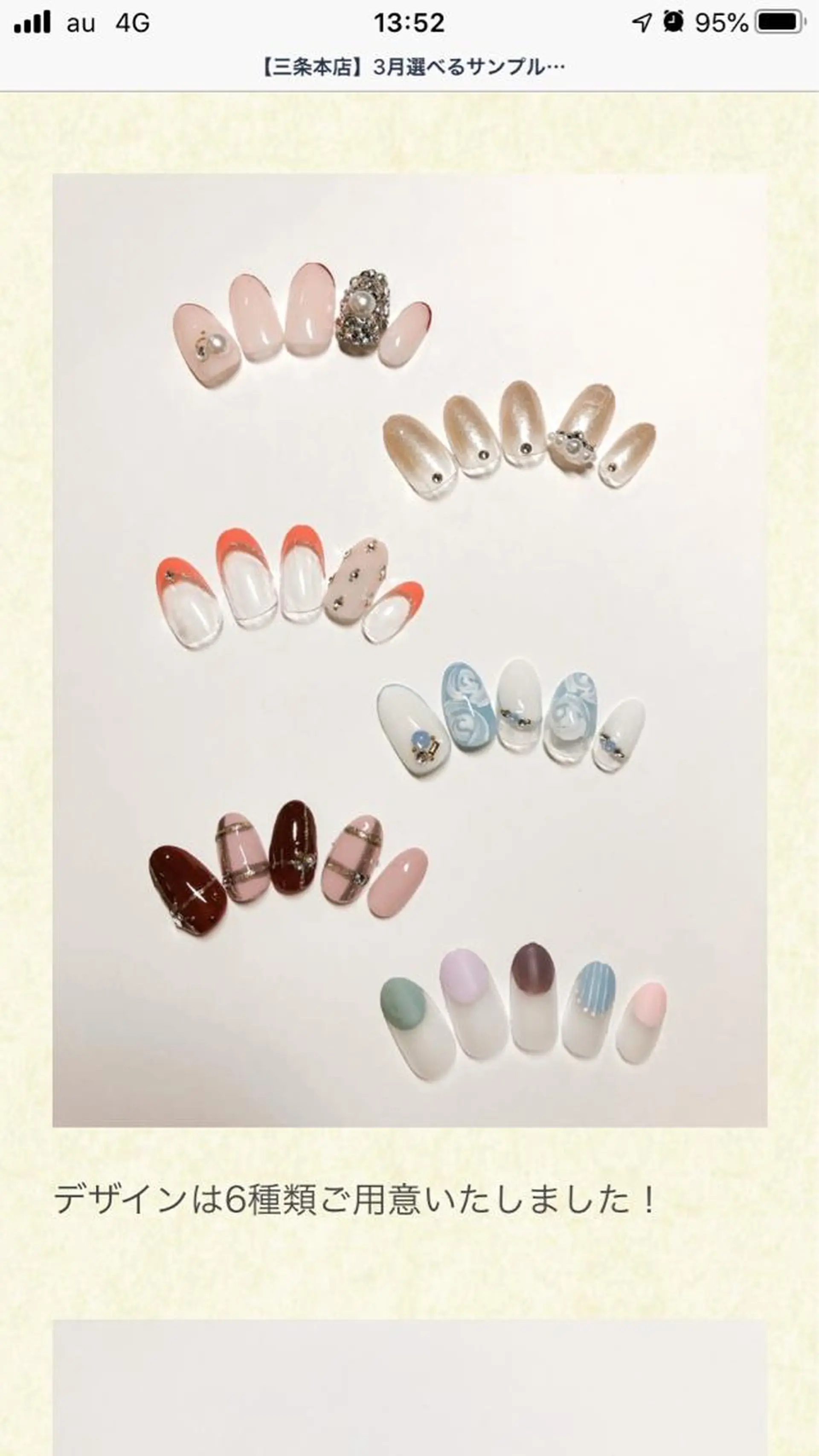 ミディアム 深爪・巻き爪 専門サンセリテのネイルデザイン