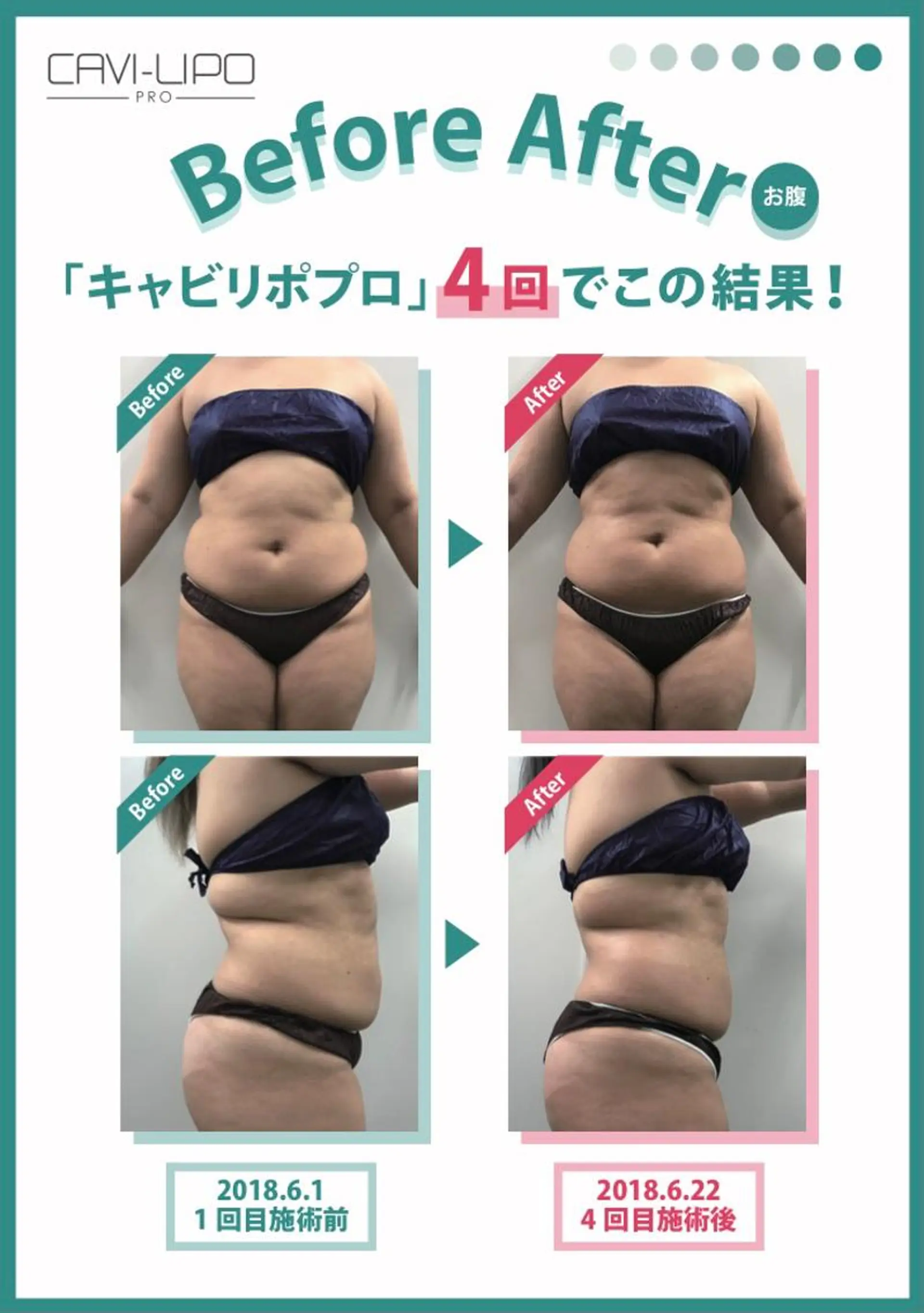 エステサロン JURISのエステ・リラクイメージ