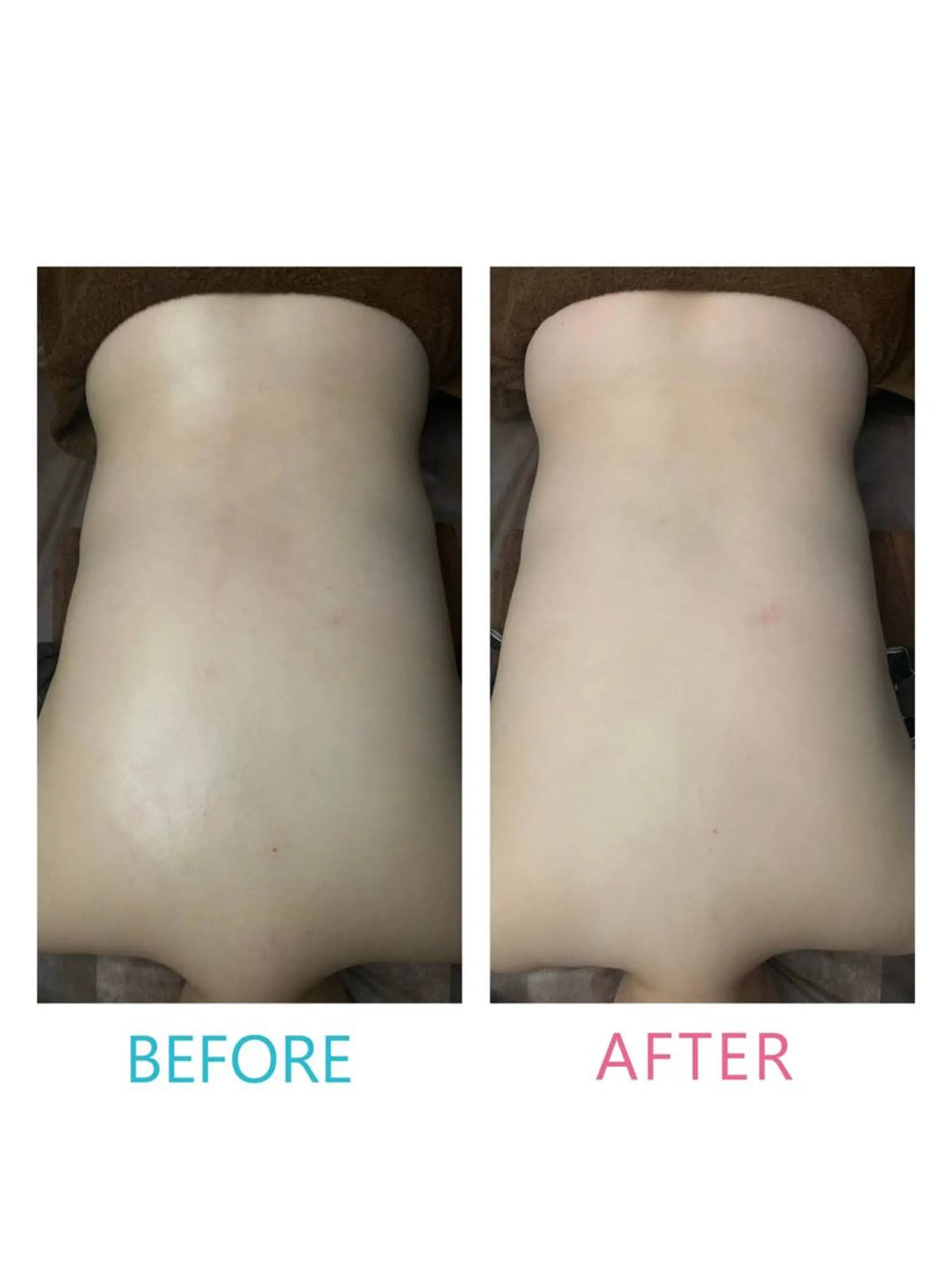 うえば すみかのエステ・リラクイメージ