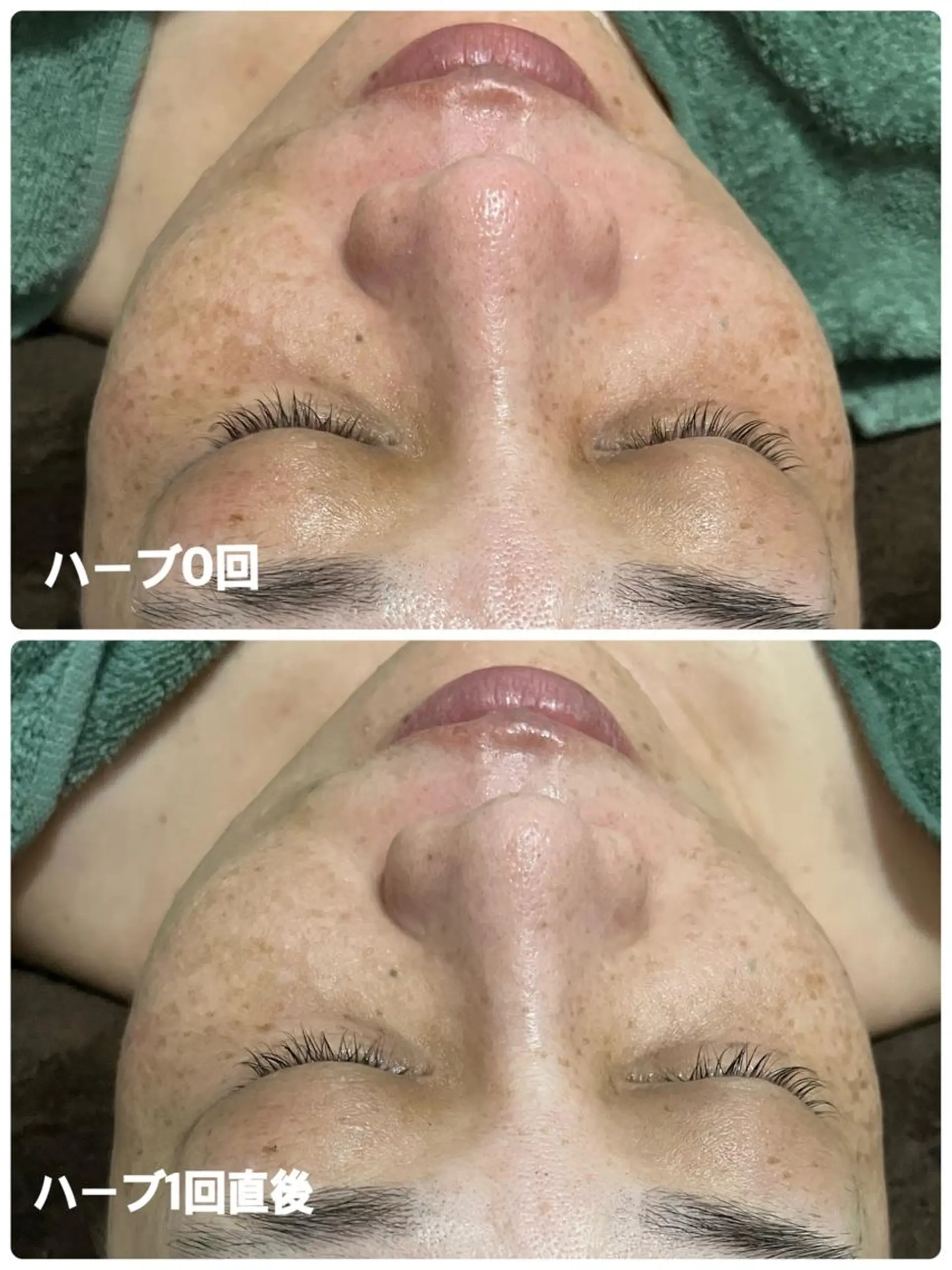 エステ SALON BioBioのエステ・リラクイメージ