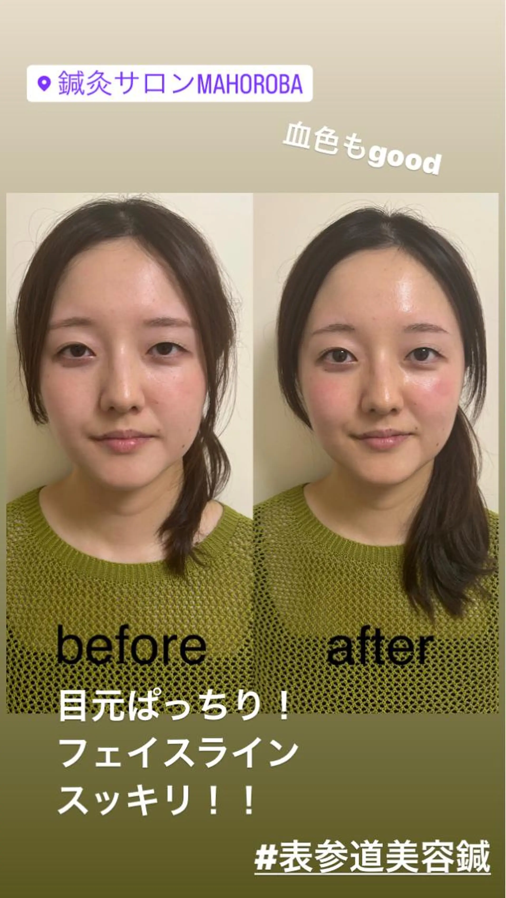 美容鍼灸サロン mahoroba院長のエステ・リラクイメージ